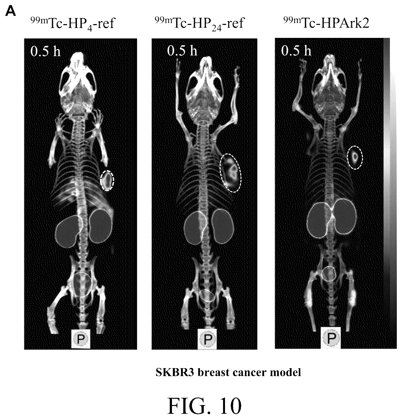 Patent US12576170 Figure 12 – Rk polypeptide radiopharmaceutical targeting HER2 and preparation method thereof