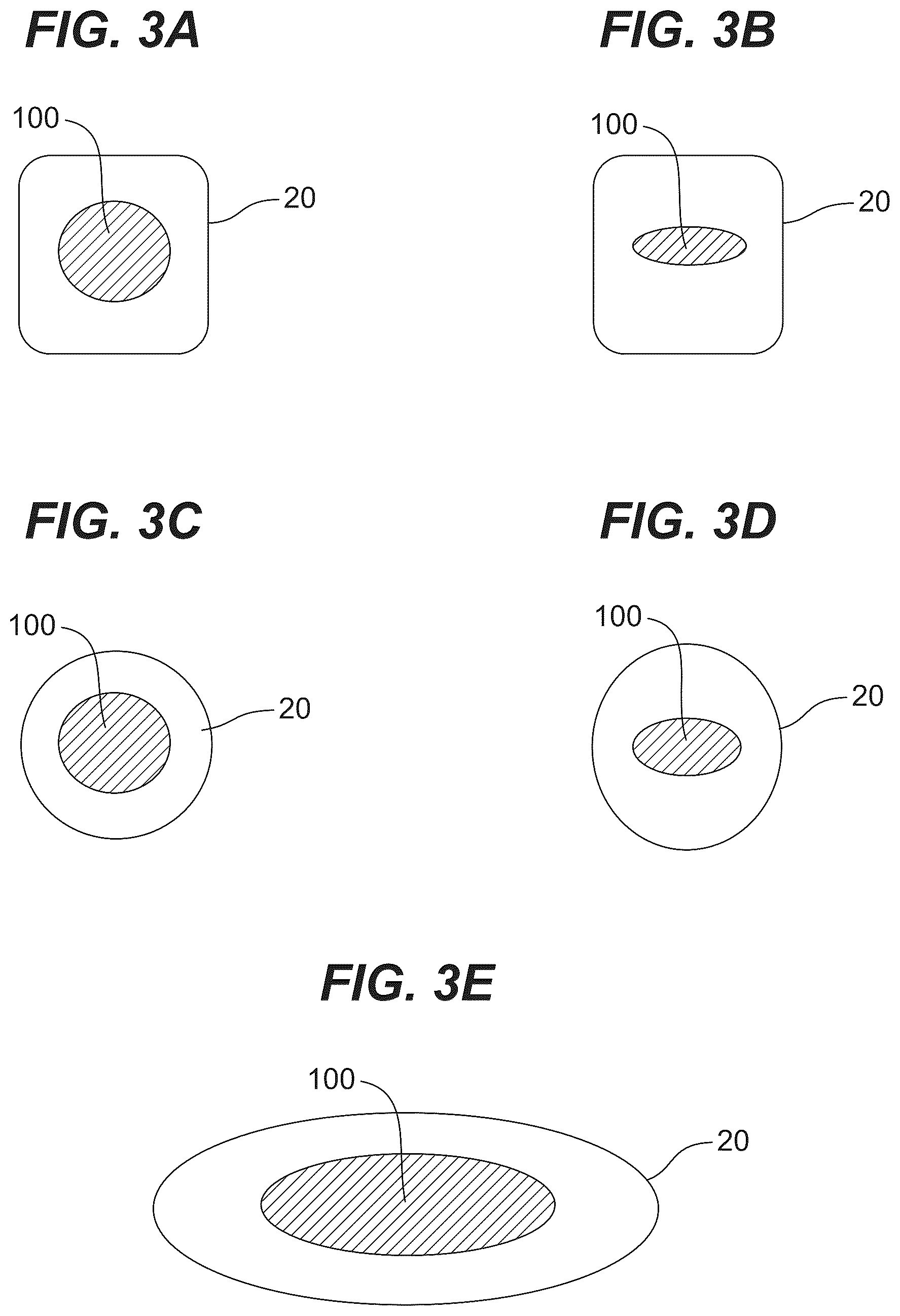 Patent US12576182 Figure 6 – Absorbable dressings for sealing sensitive neural tissue and dura matter