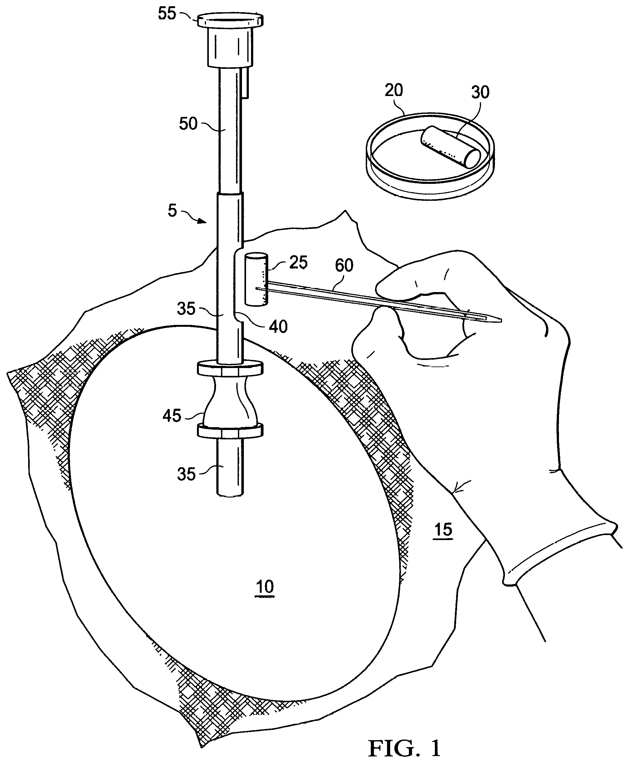 Patent US12576186 — Collagen pellet and methods for making and use — Figure 1