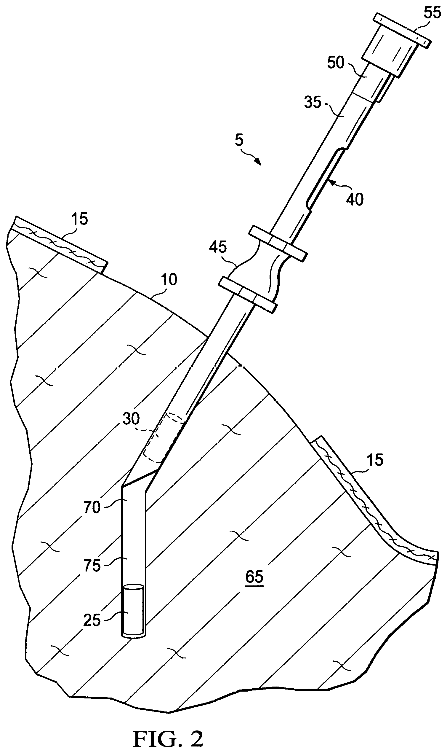 Patent US12576186 Figure 2 – Collagen pellet and methods for making and use