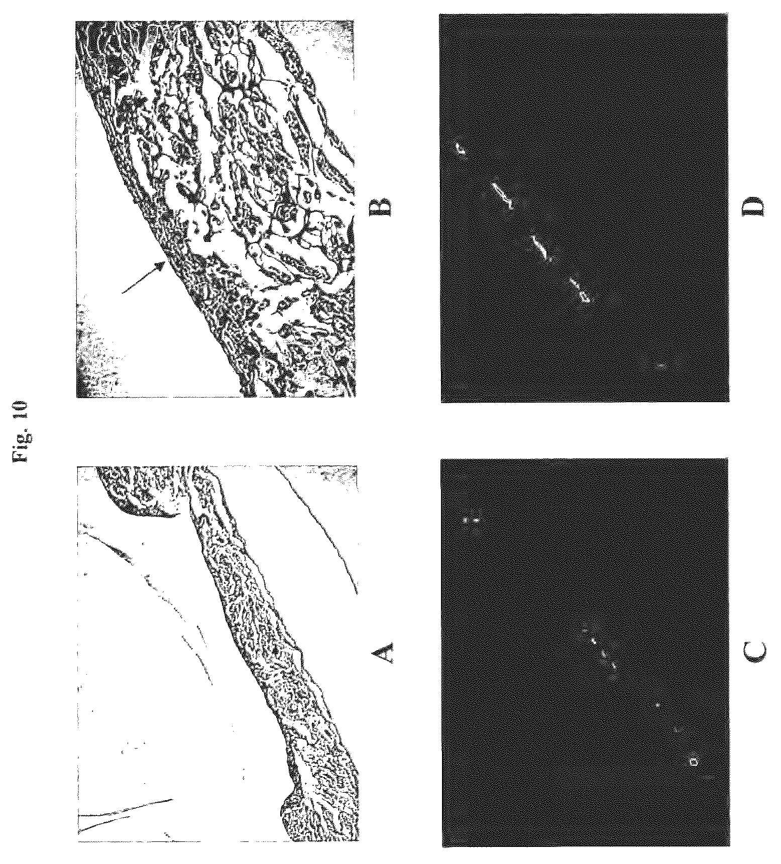 Patent US12576188 Figure 10 – Engineered three-dimensional skin tissues, arrays thereof, and methods of making the same