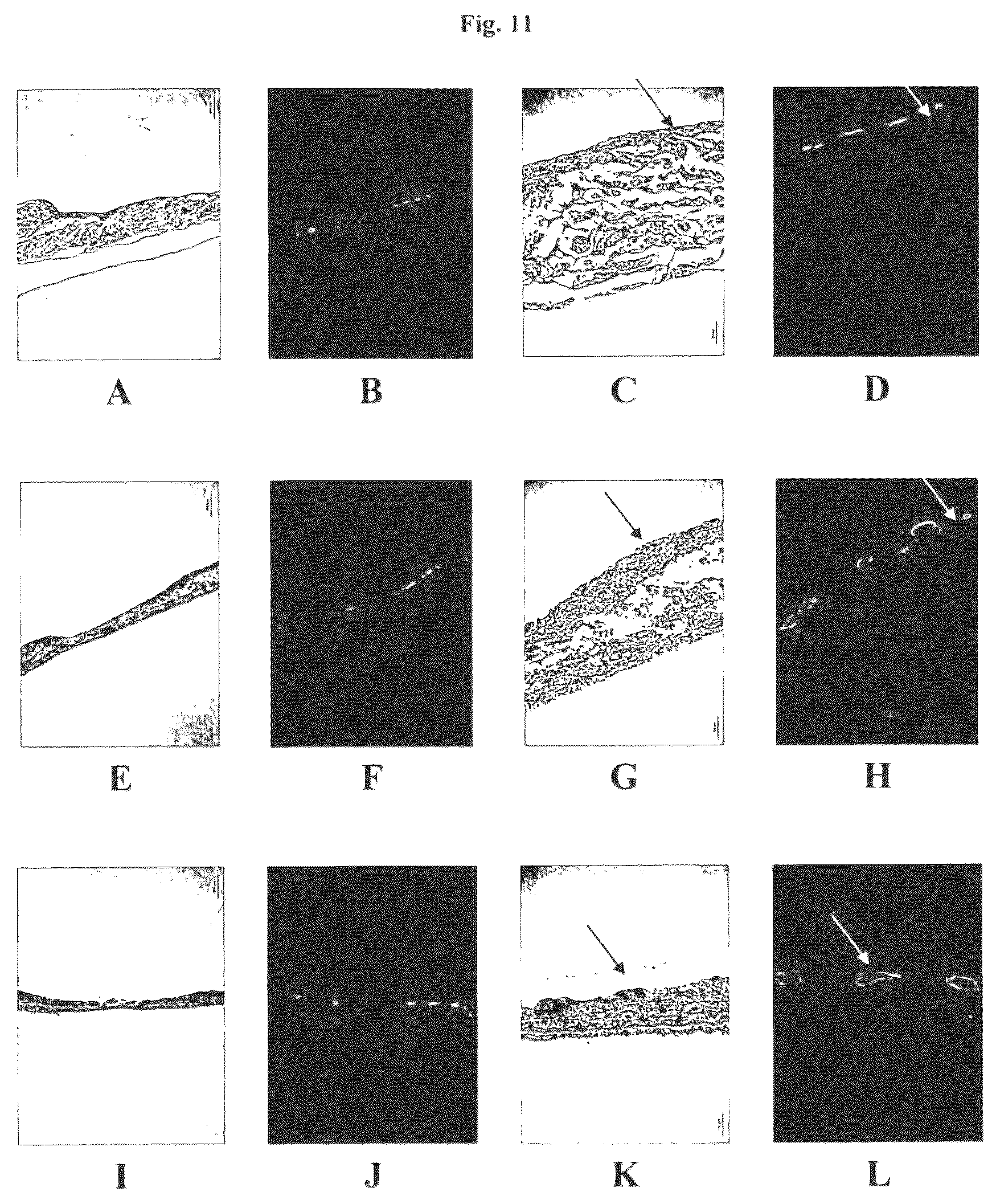Patent US12576188 Figure 11 – Engineered three-dimensional skin tissues, arrays thereof, and methods of making the same