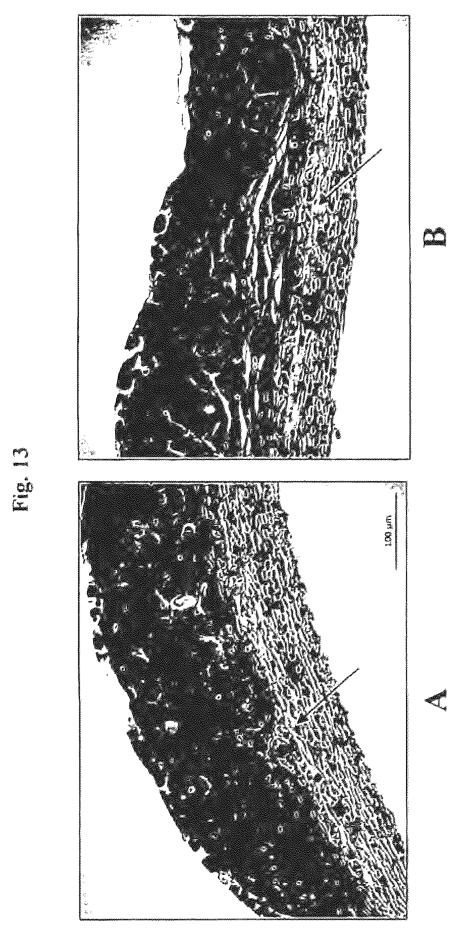 Patent US12576188 Figure 13 – Engineered three-dimensional skin tissues, arrays thereof, and methods of making the same
