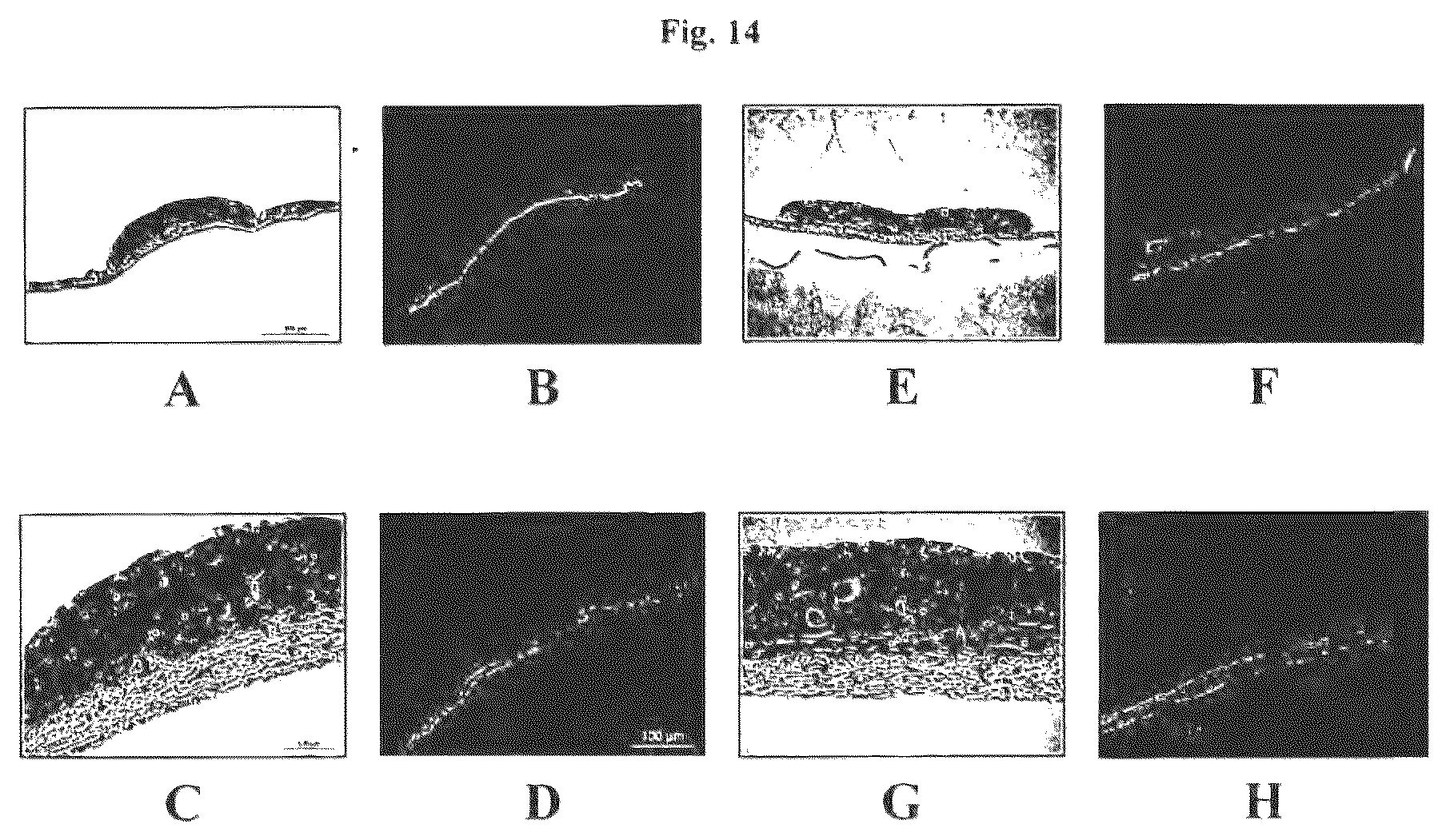 Patent US12576188 Figure 14 – Engineered three-dimensional skin tissues, arrays thereof, and methods of making the same