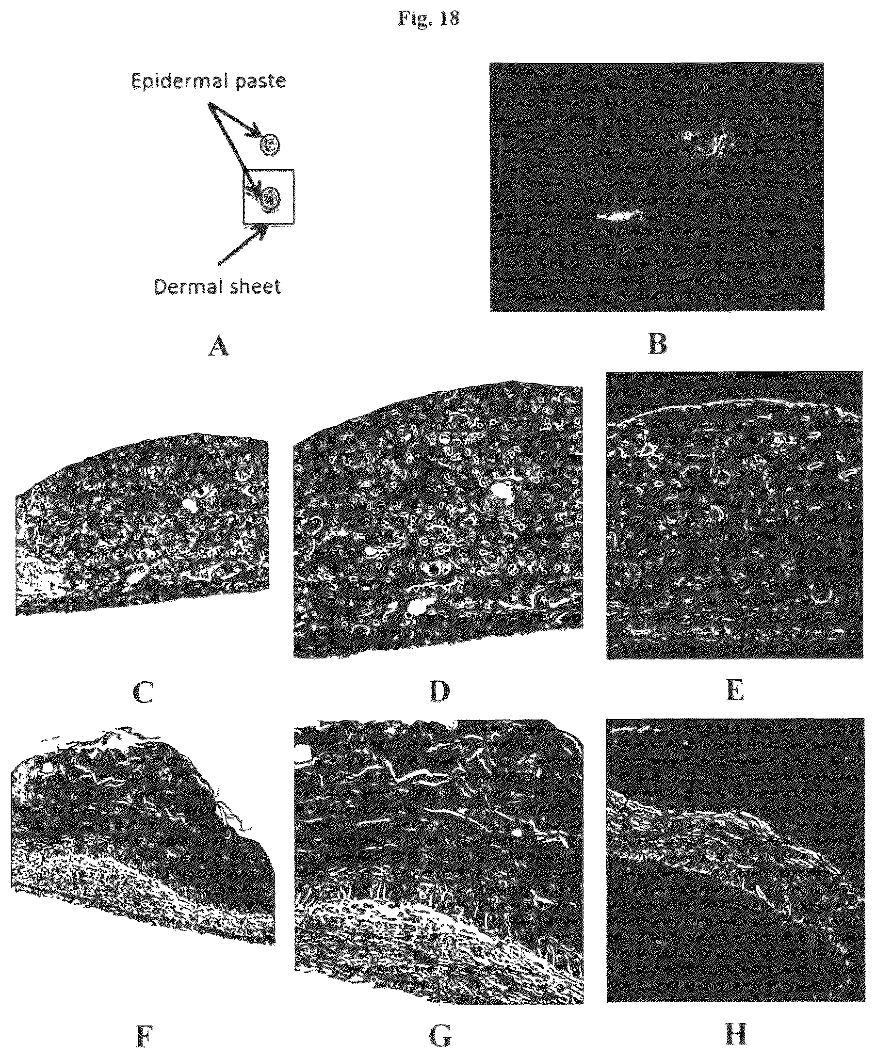 Patent US12576188 Figure 18 – Engineered three-dimensional skin tissues, arrays thereof, and methods of making the same