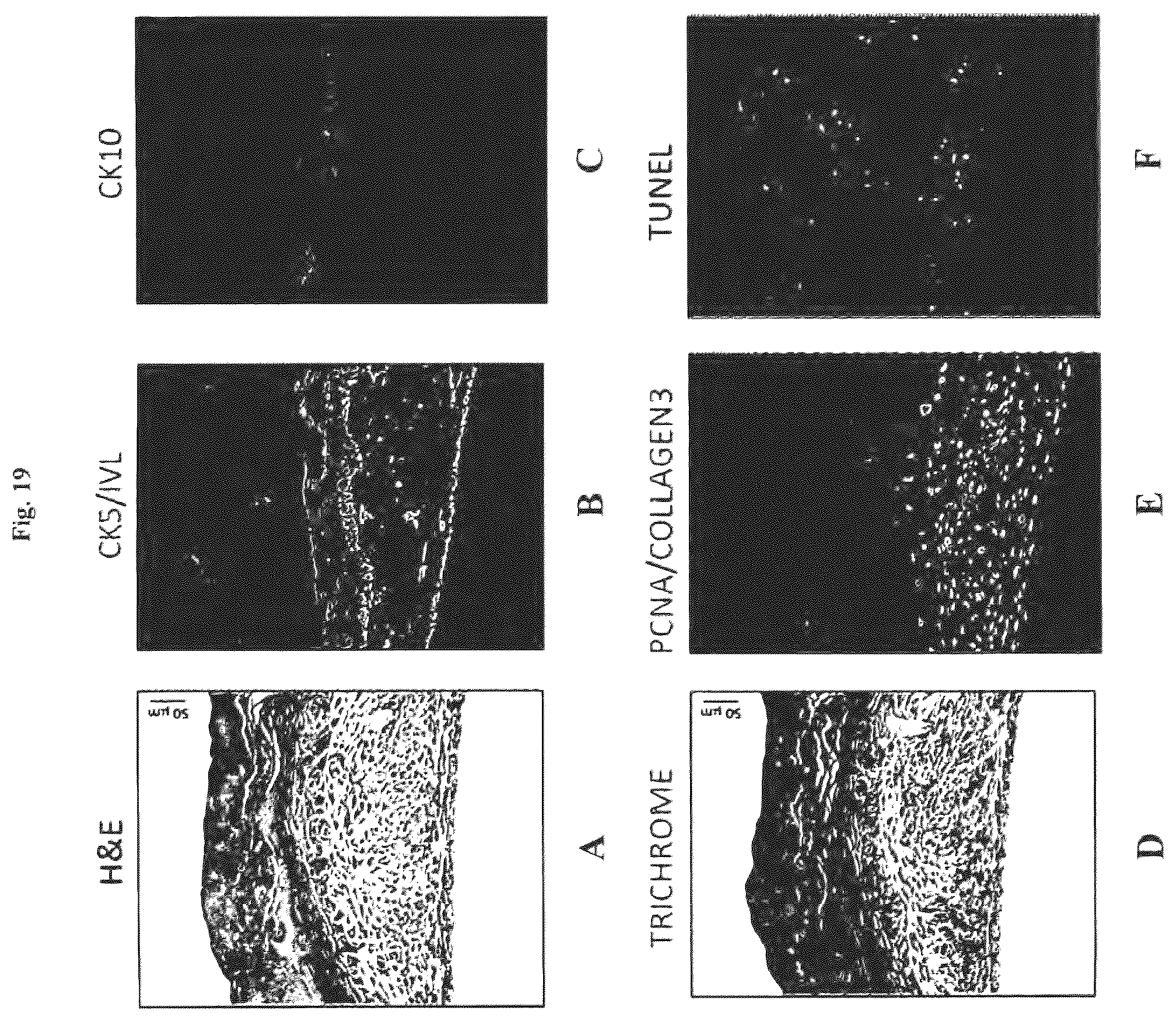 Patent US12576188 Figure 19 – Engineered three-dimensional skin tissues, arrays thereof, and methods of making the same