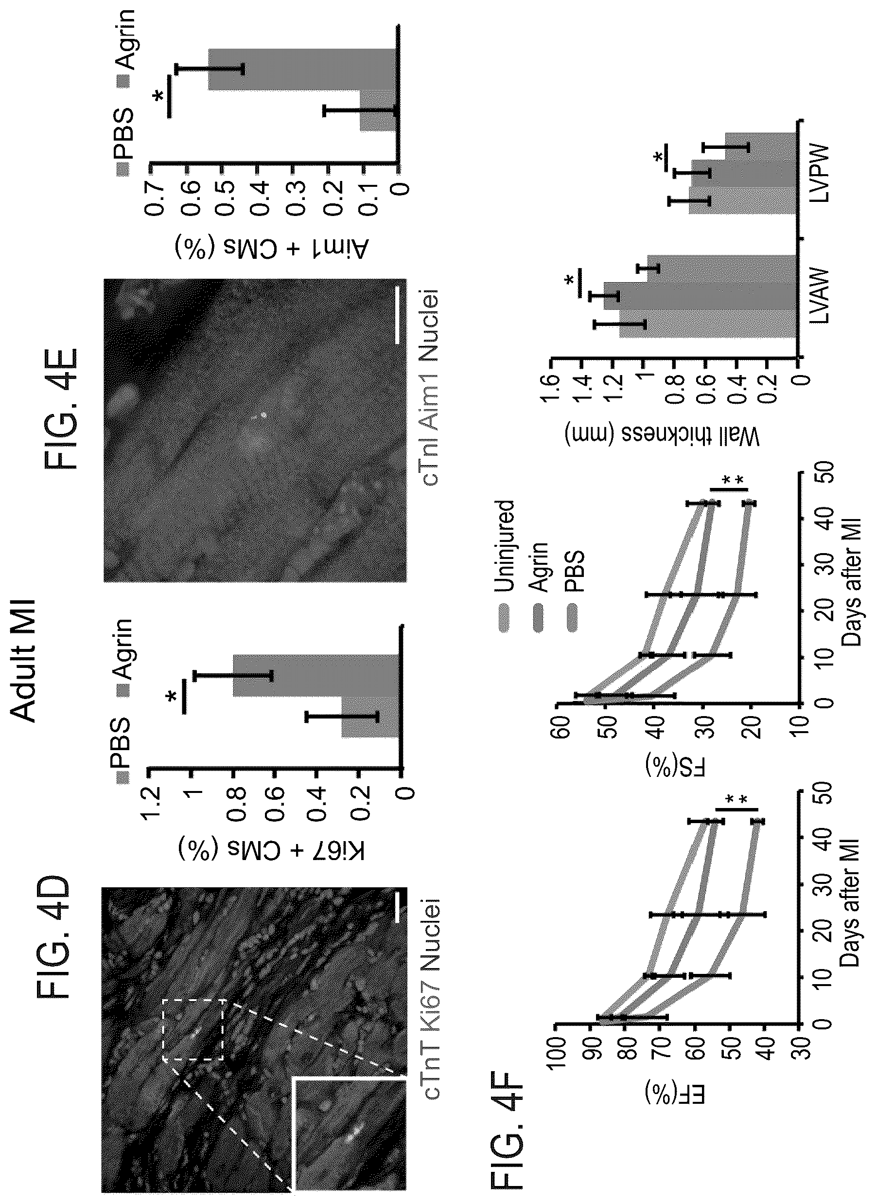 Patent US12576191 Figure 10 – Method of inducing cardiomyocytes proliferation and treating heart diseases