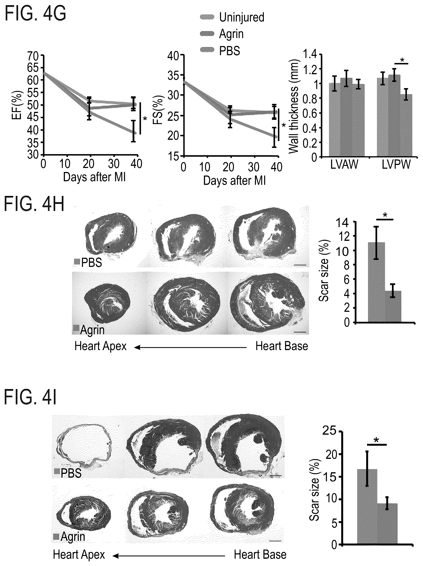 Patent US12576191 Figure 11 – Method of inducing cardiomyocytes proliferation and treating heart diseases