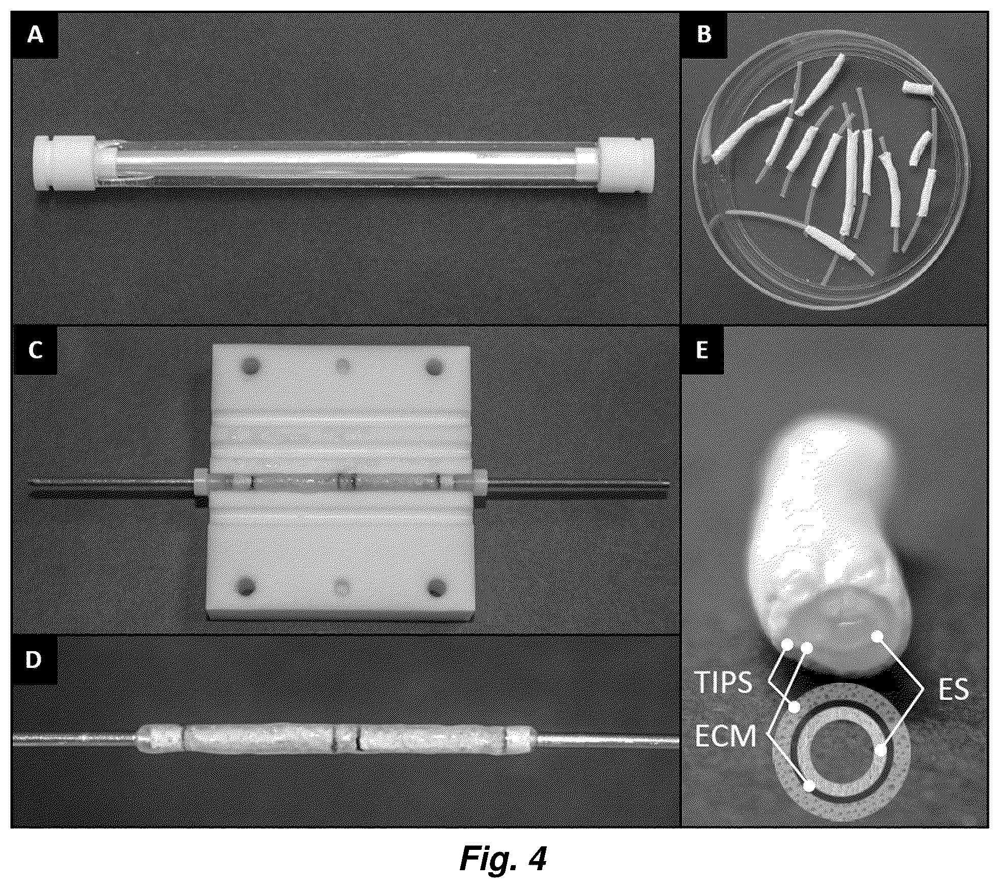 Patent US12576192 Figure 4 – Multi-layered graft for tissue engineering applications