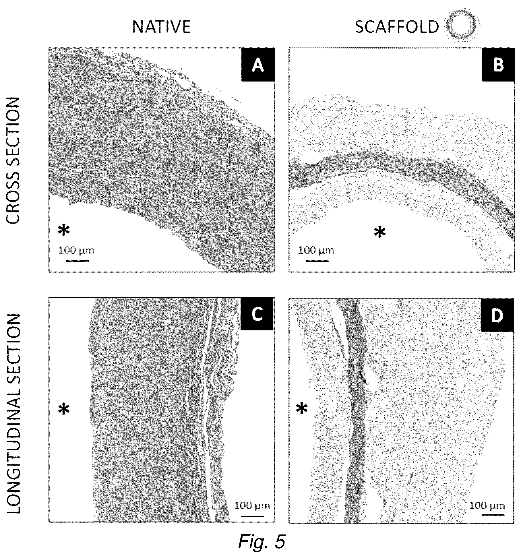 Patent US12576192 Figure 5 – Multi-layered graft for tissue engineering applications