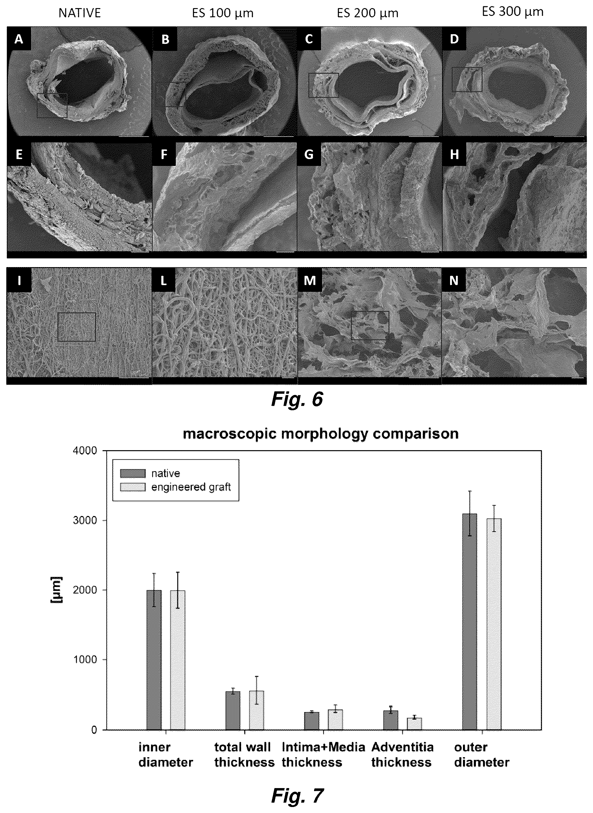 Patent US12576192 Figure 6 – Multi-layered graft for tissue engineering applications