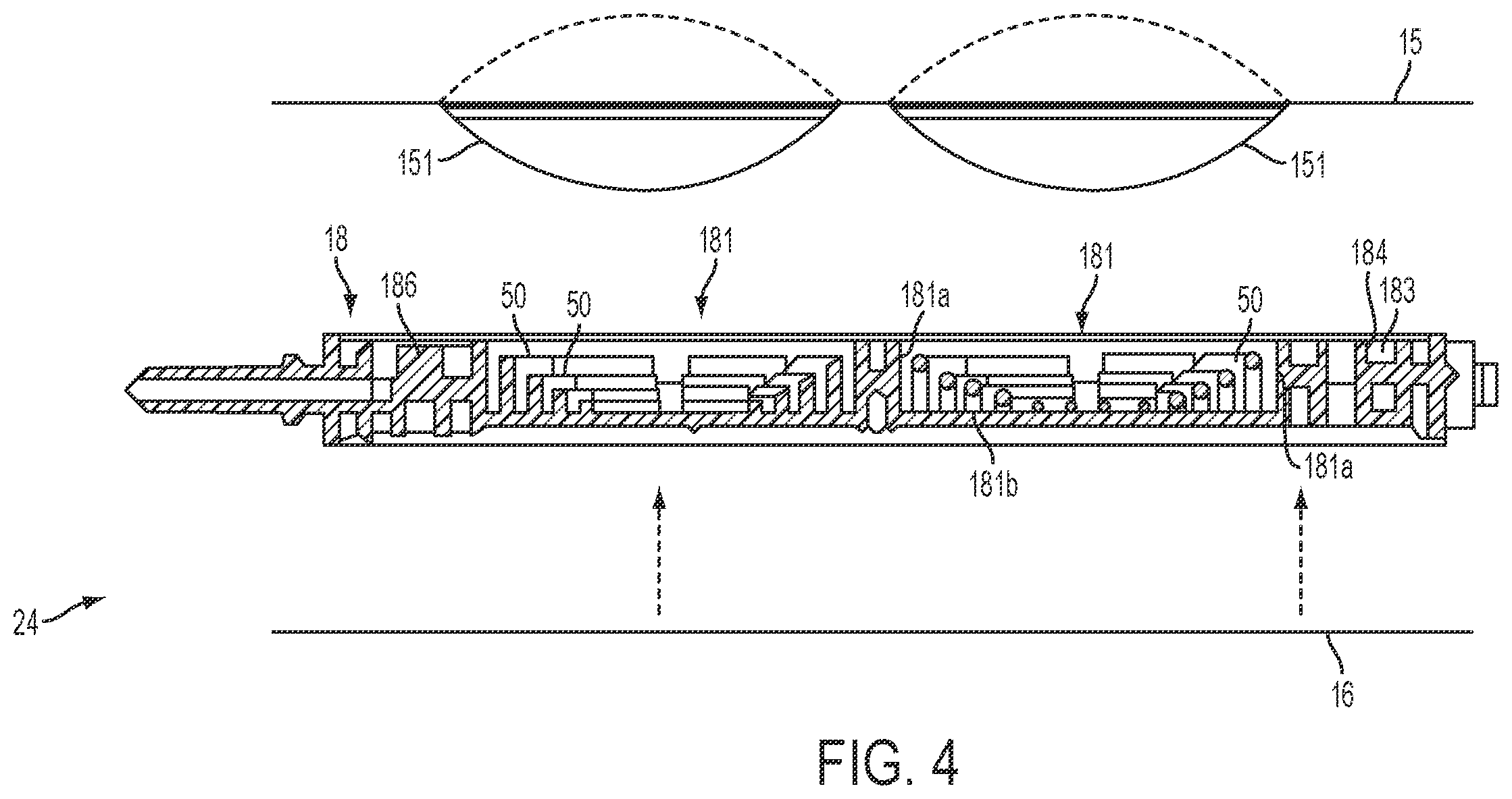 Patent US12576197 Figure 5 – Medical treatment systems, methods, and apparatuses using a plurality of fluid lines