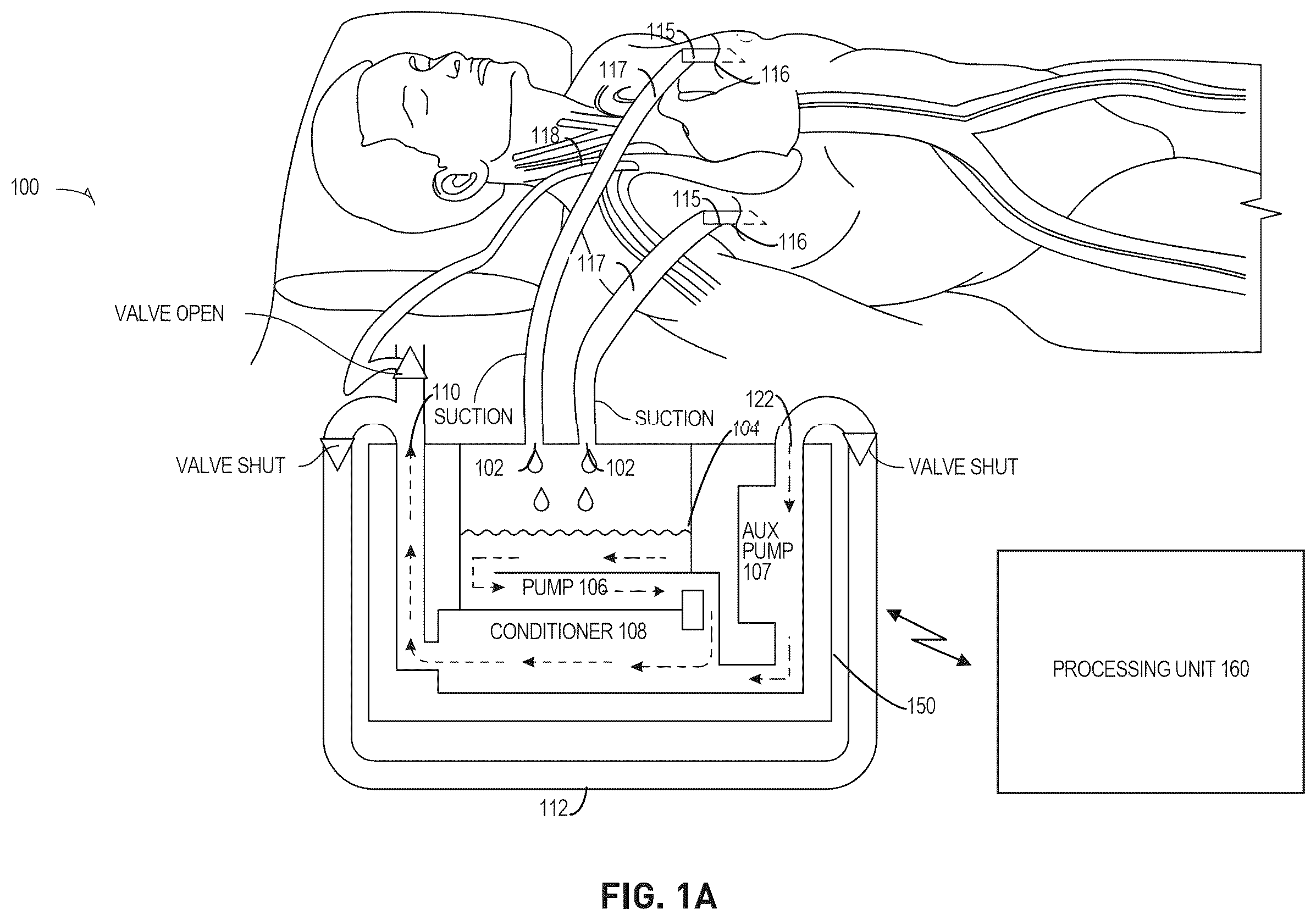 Patent US12576198 Figure 1 – Trauma patient hemorrhage control including rapid autotransfusion