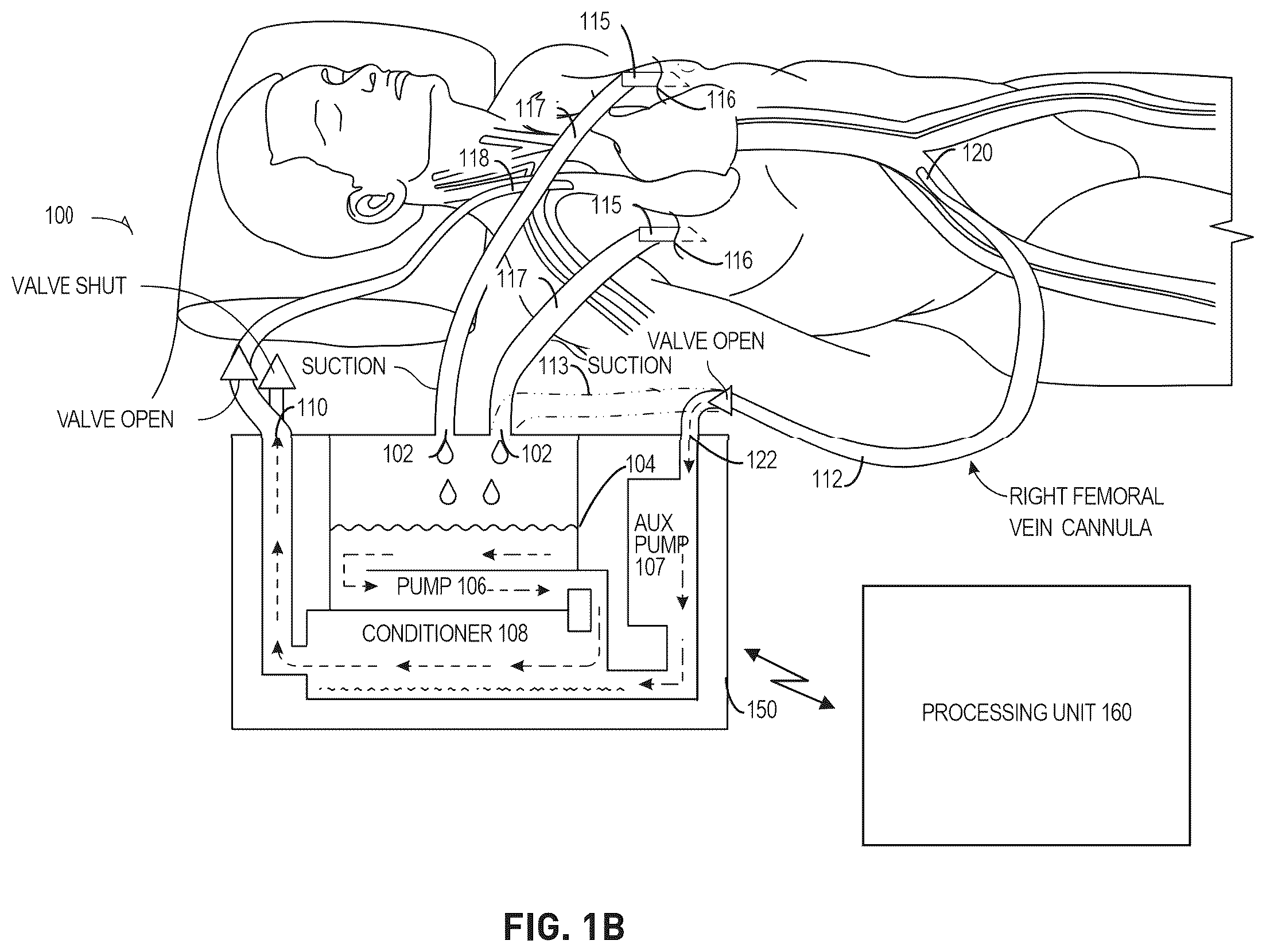 Patent US12576198 Figure 2 – Trauma patient hemorrhage control including rapid autotransfusion