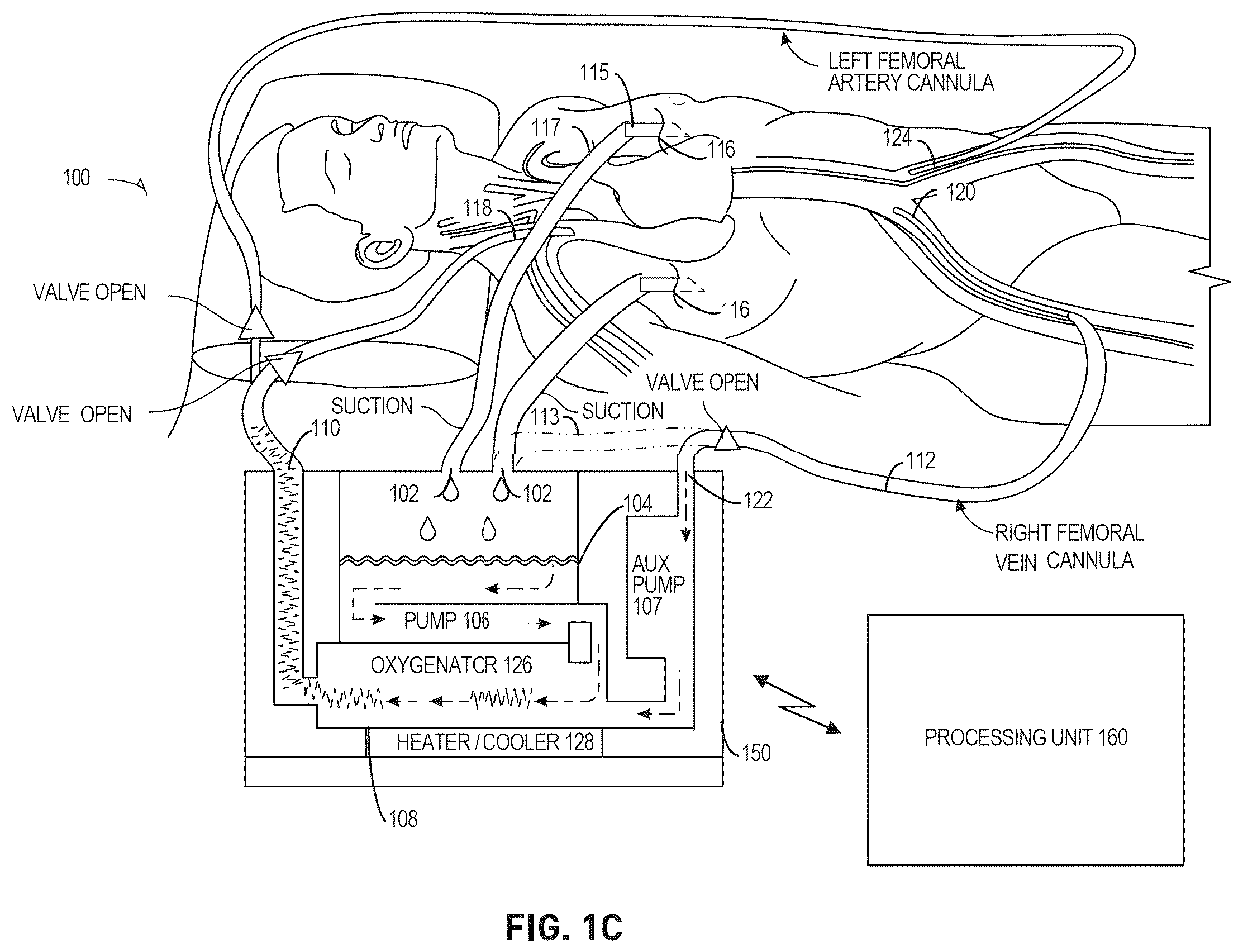 Patent US12576198 Figure 3 – Trauma patient hemorrhage control including rapid autotransfusion