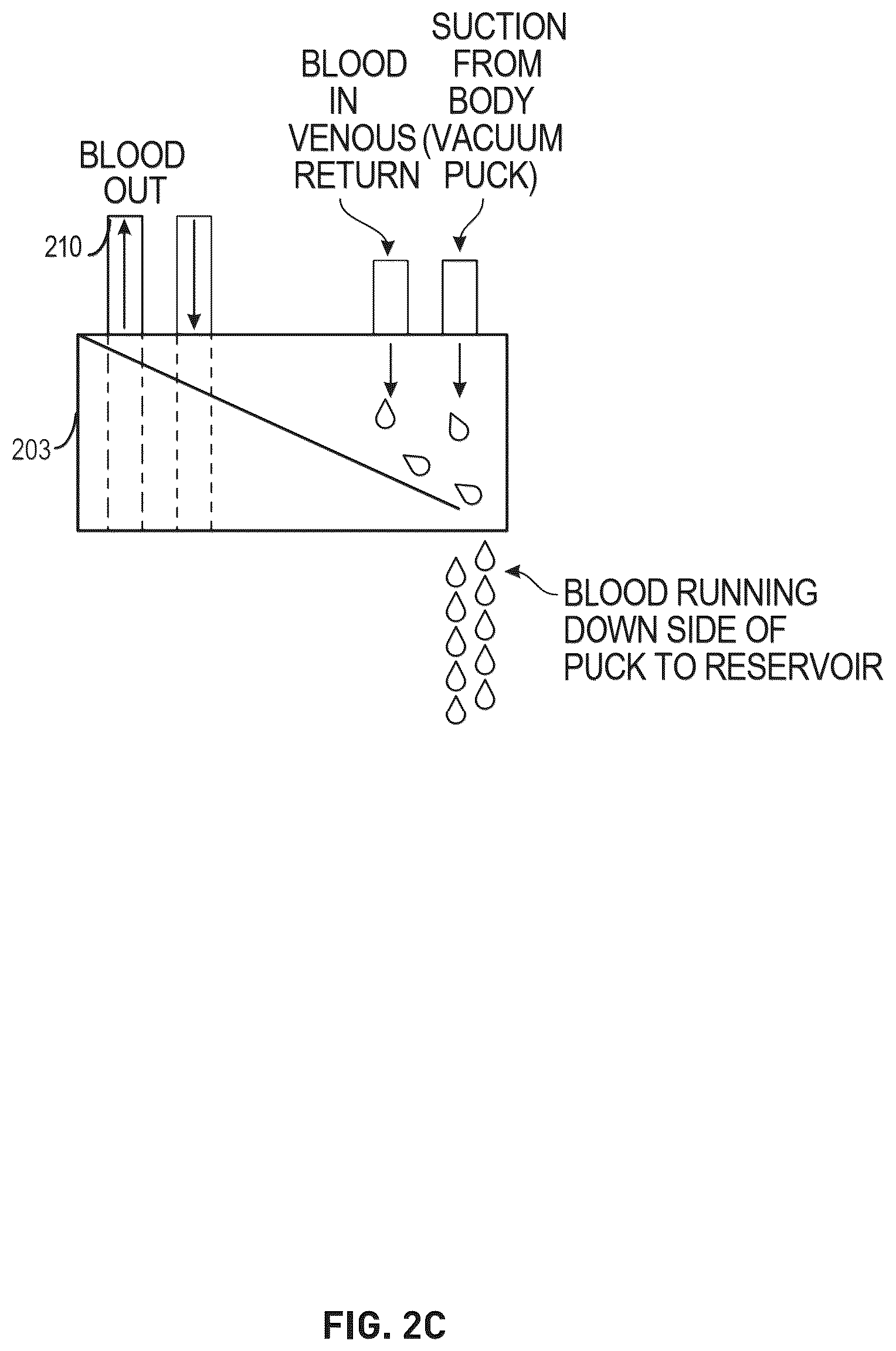 Patent US12576198 Figure 6 – Trauma patient hemorrhage control including rapid autotransfusion