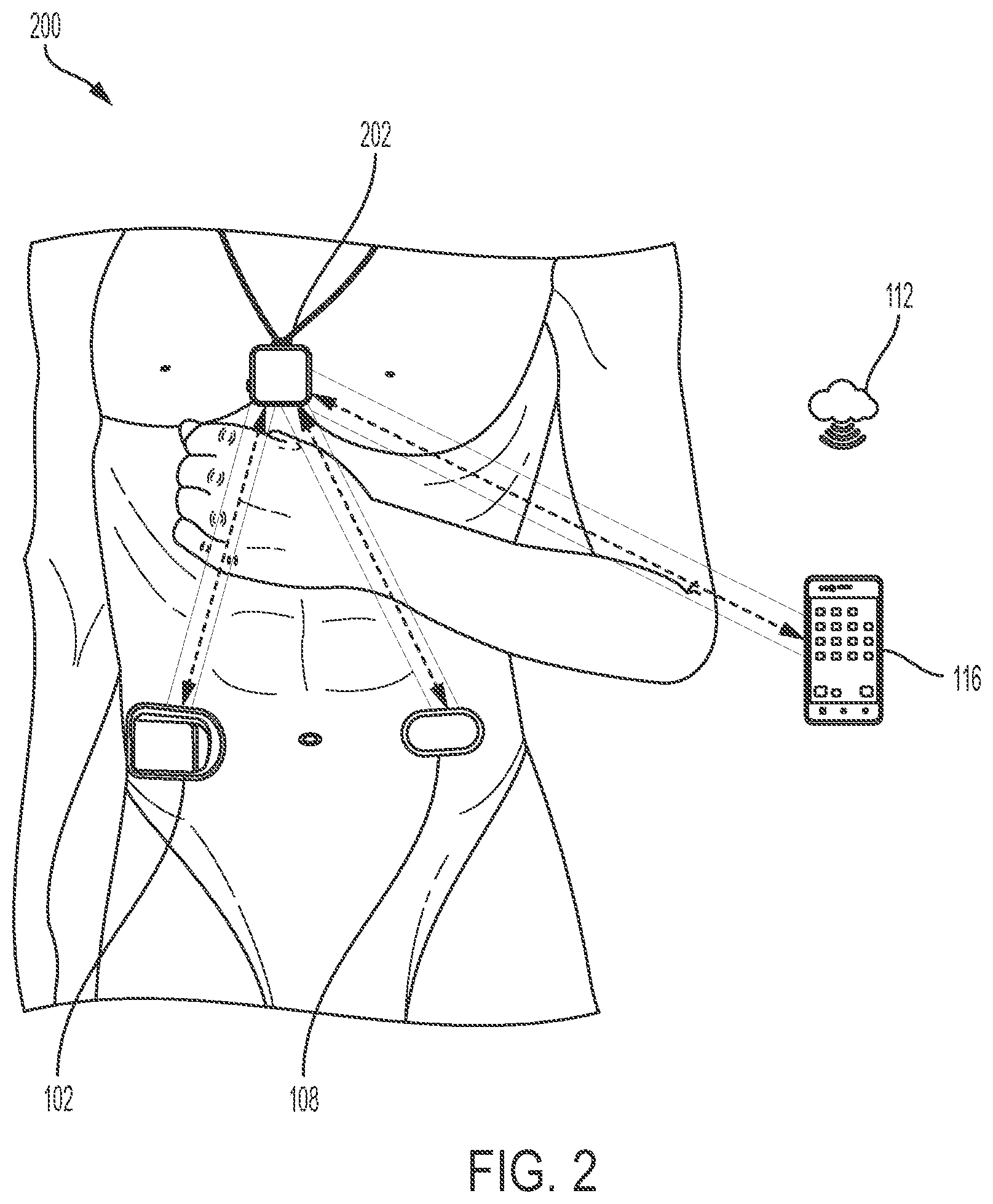 Patent US12576206 Figure 3 – Wearable automated medication delivery system