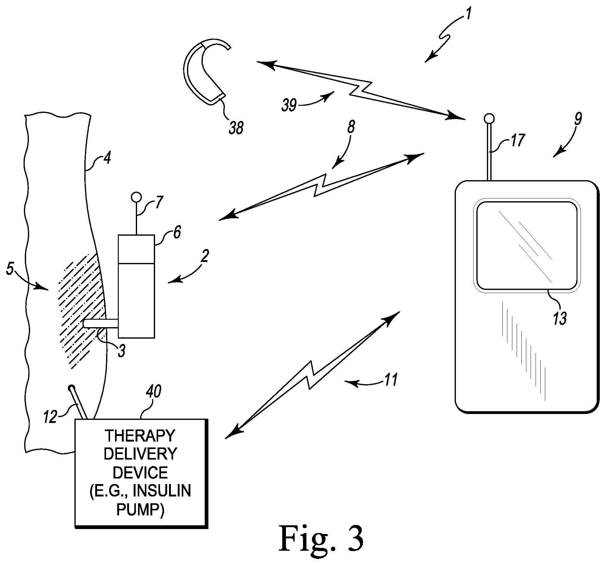 Patent US12576207 Figure 3 – Computer-implemented diabetes management methods