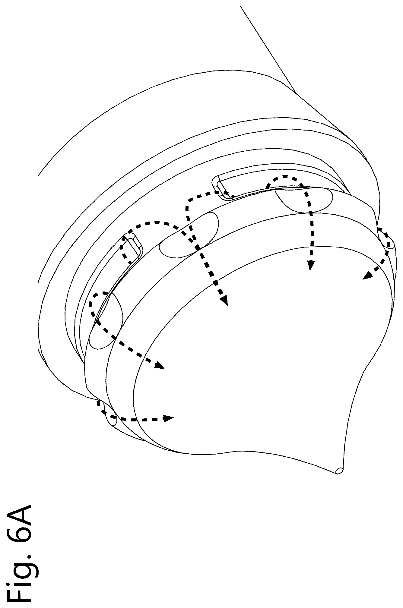 Patent US12576211 Figure 6 – Refill system for medical device using jet delivery principle