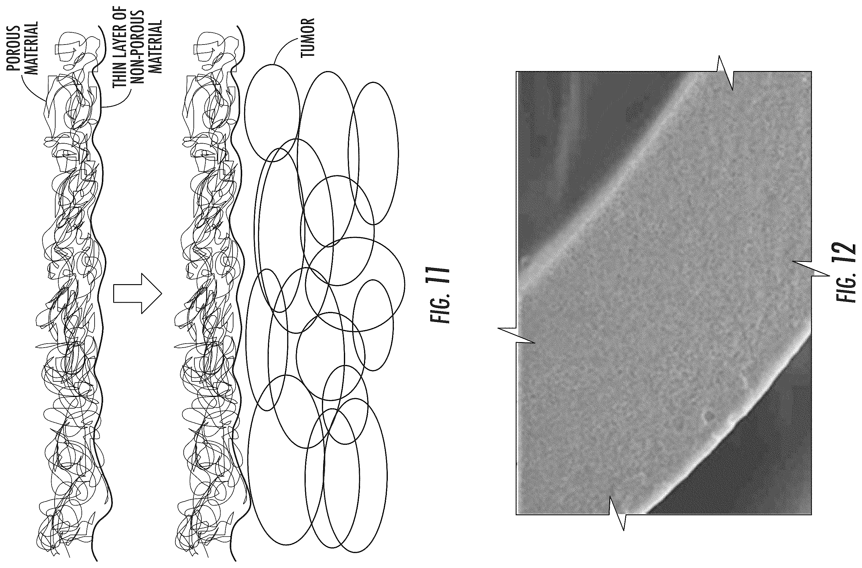 Patent US12576220 Figure 9 – Devices, systems and methods for improved radiotherapy efficacy