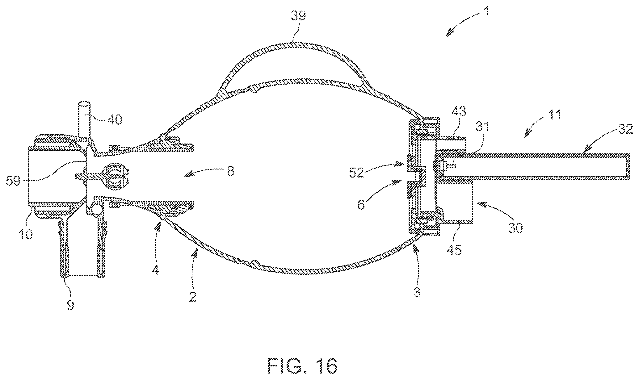 Patent US12576224 Figure 10 – Resuscitator
