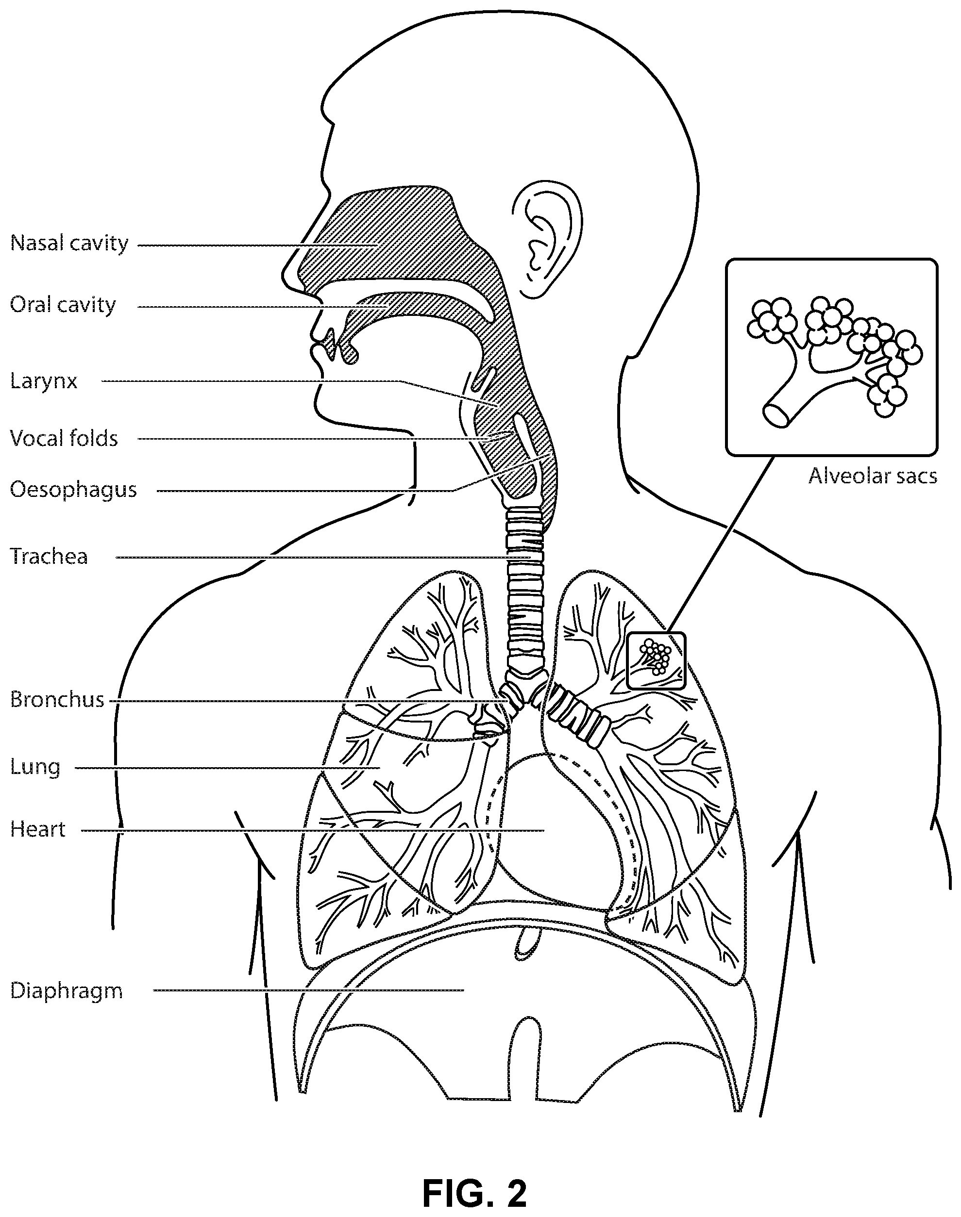 Patent US12576225 Figure 2 – Methods and apparatus for controlling respiratory therapy