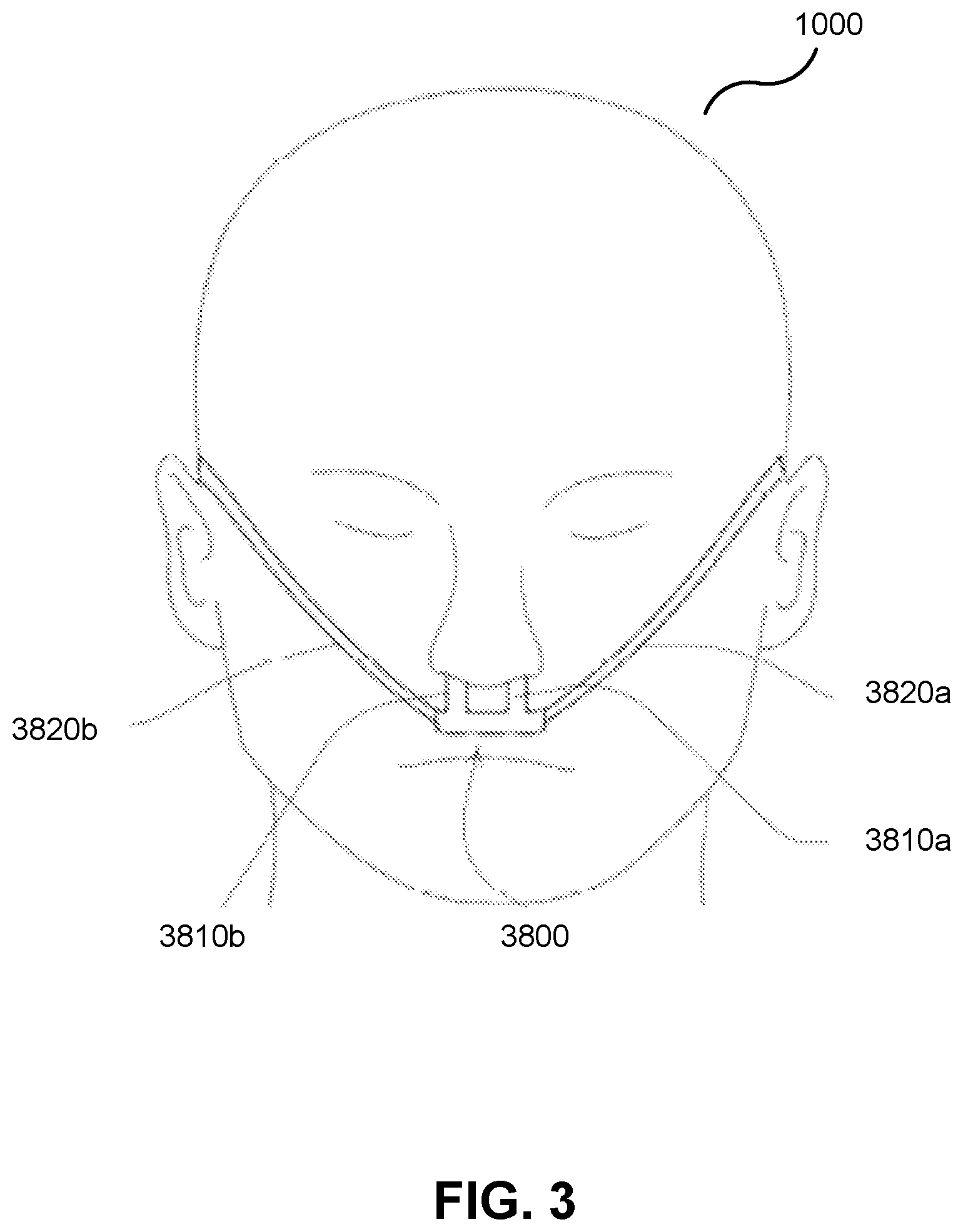 Patent US12576225 Figure 3 – Methods and apparatus for controlling respiratory therapy