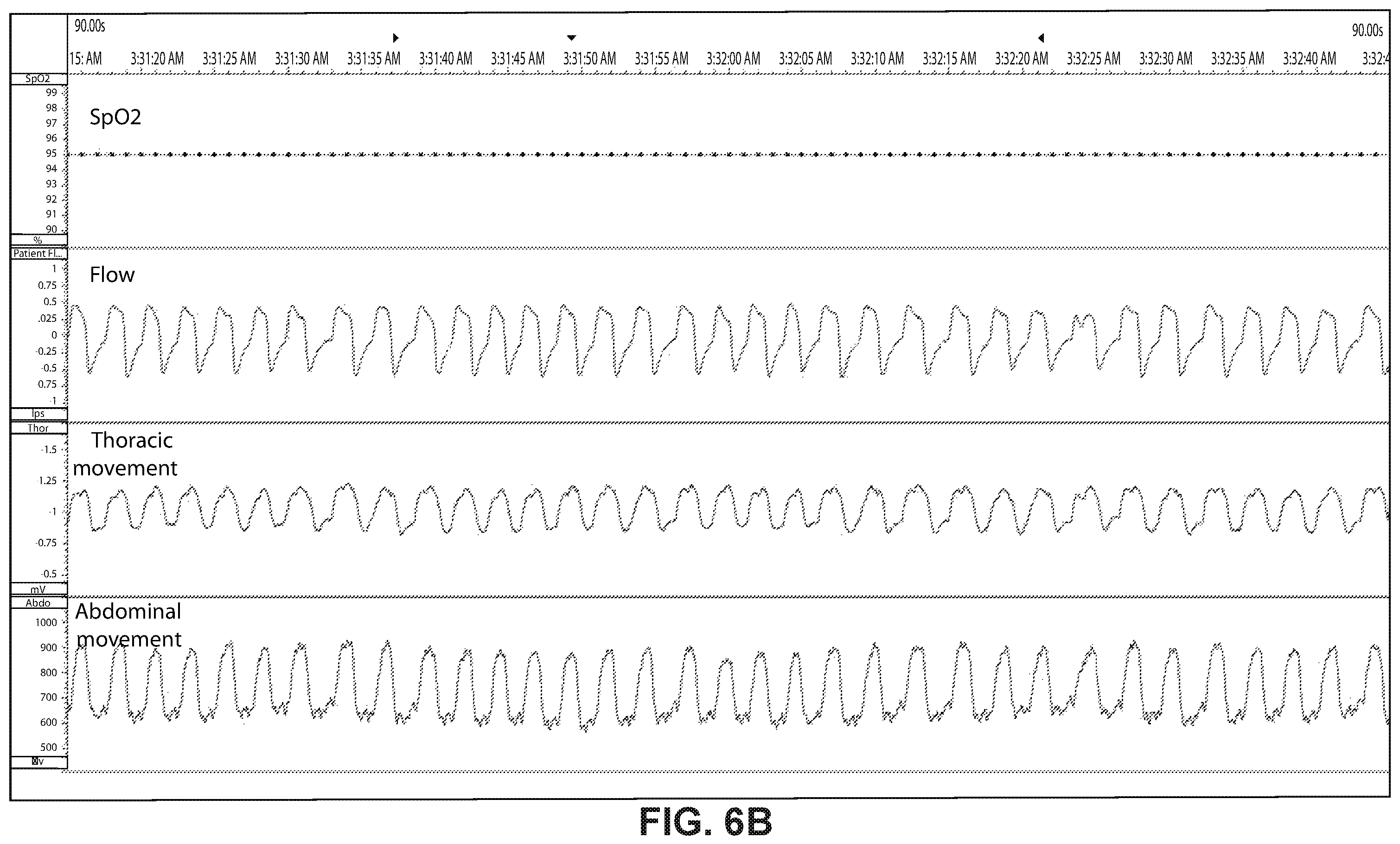 Patent US12576226 Figure 13 – Characterising systems for respiratory therapy