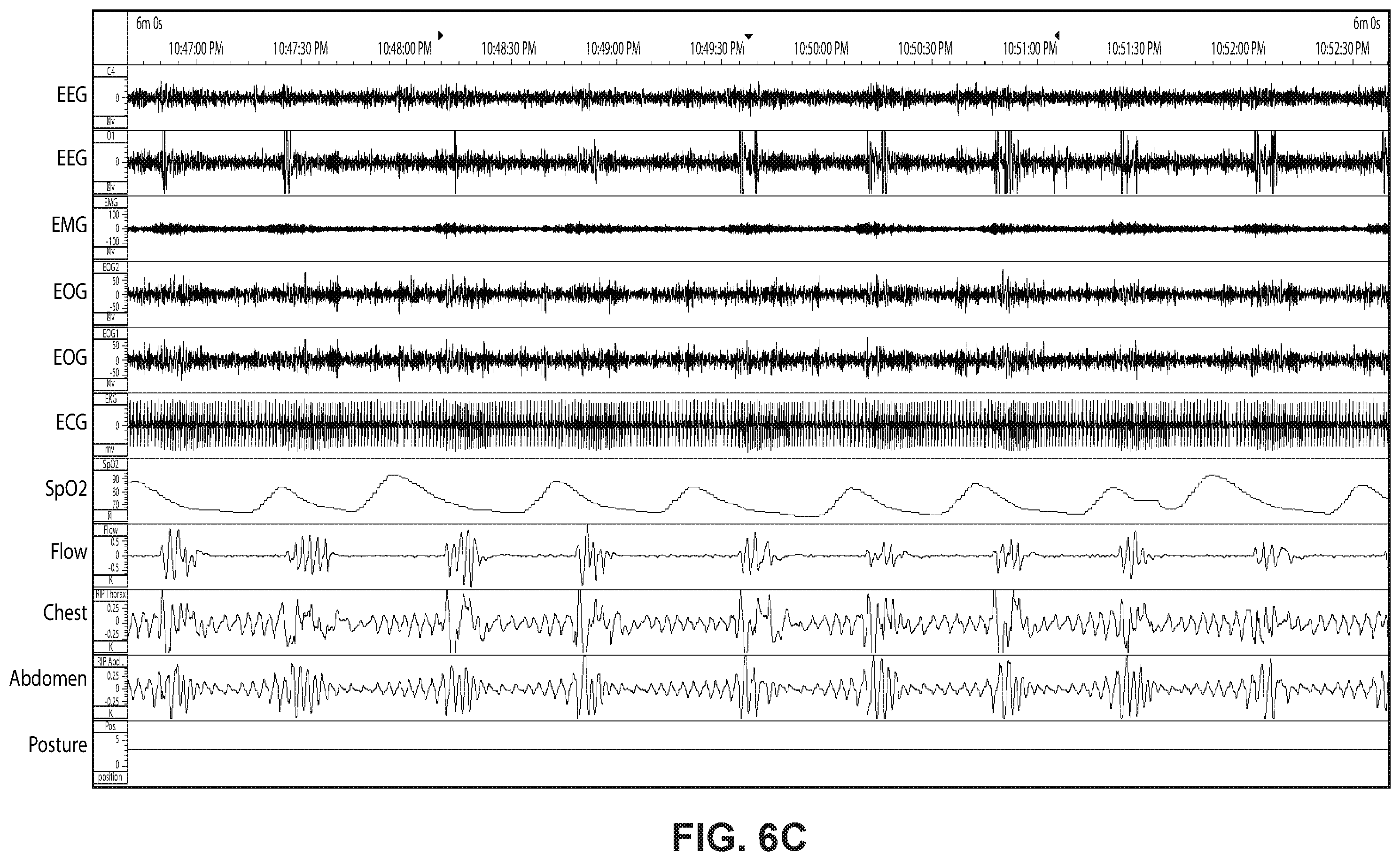 Patent US12576226 Figure 14 – Characterising systems for respiratory therapy