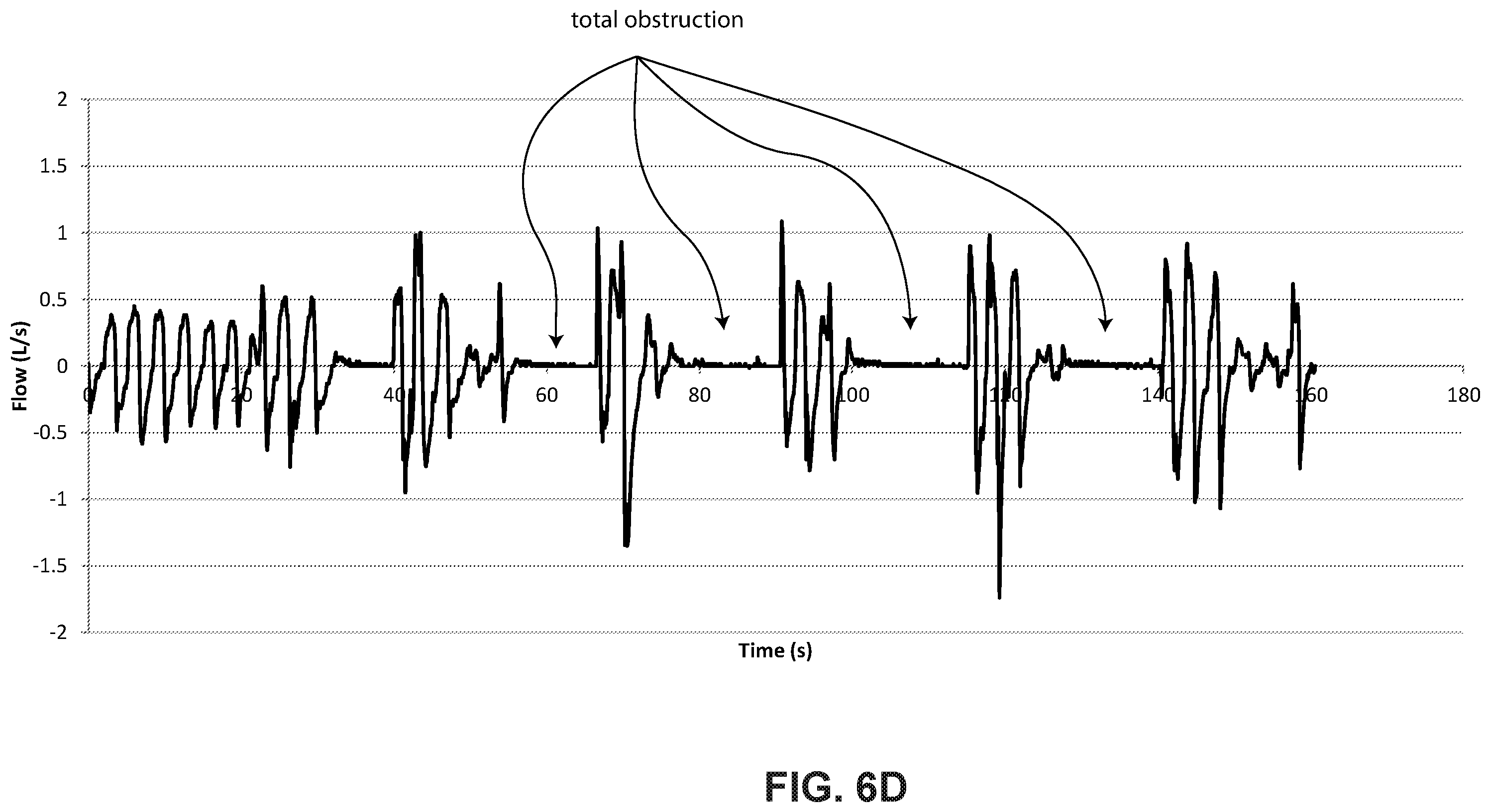 Patent US12576226 Figure 15 – Characterising systems for respiratory therapy