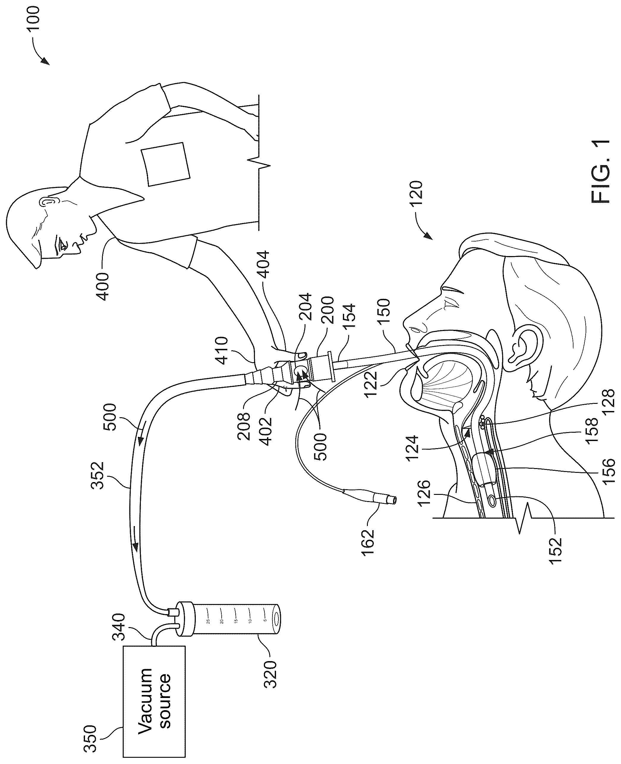 Patent US12576228 Figure 1 – Endotracheal tube adapters