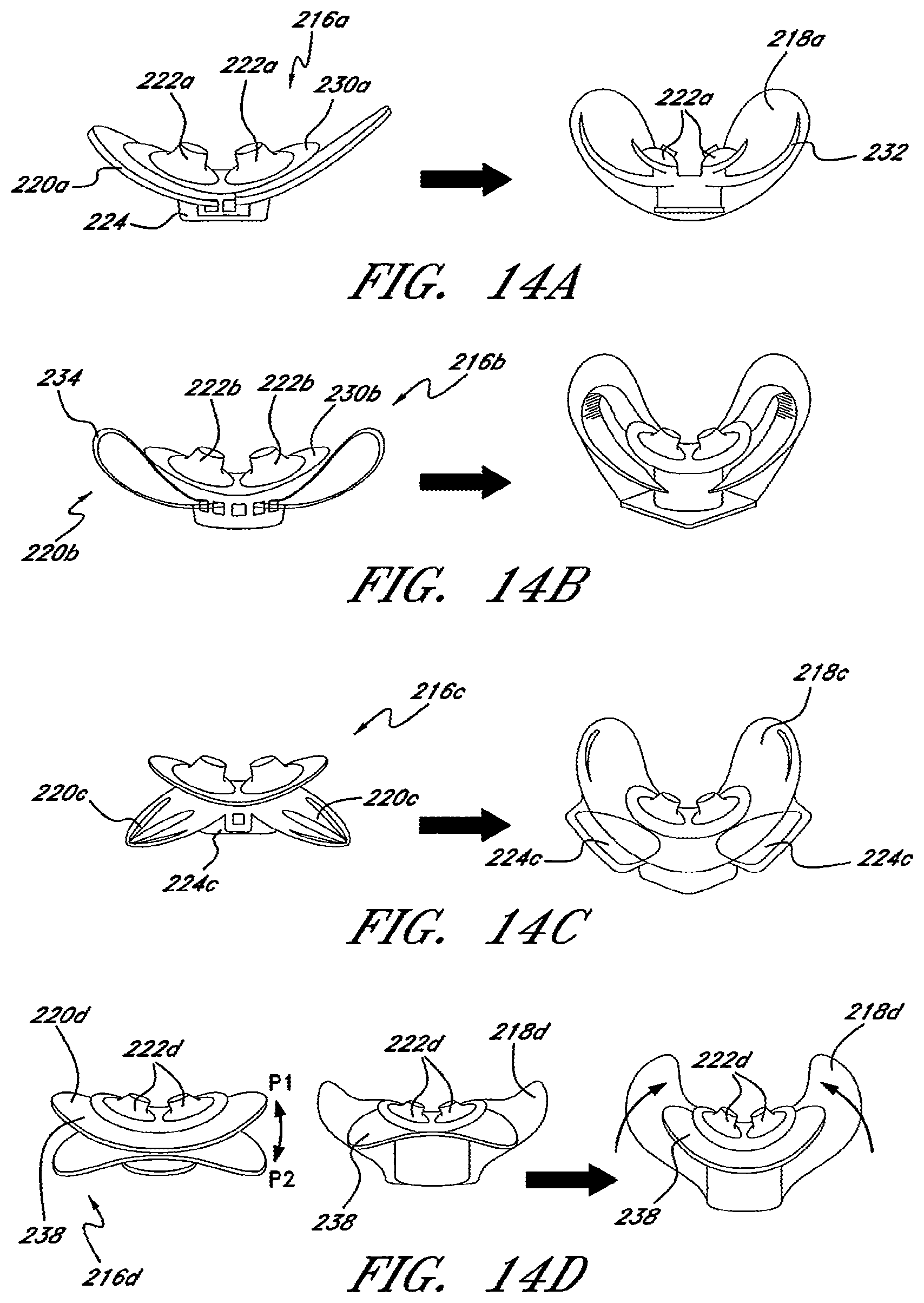Patent US12576230 Figure 10 – Patient interface and aspects thereof