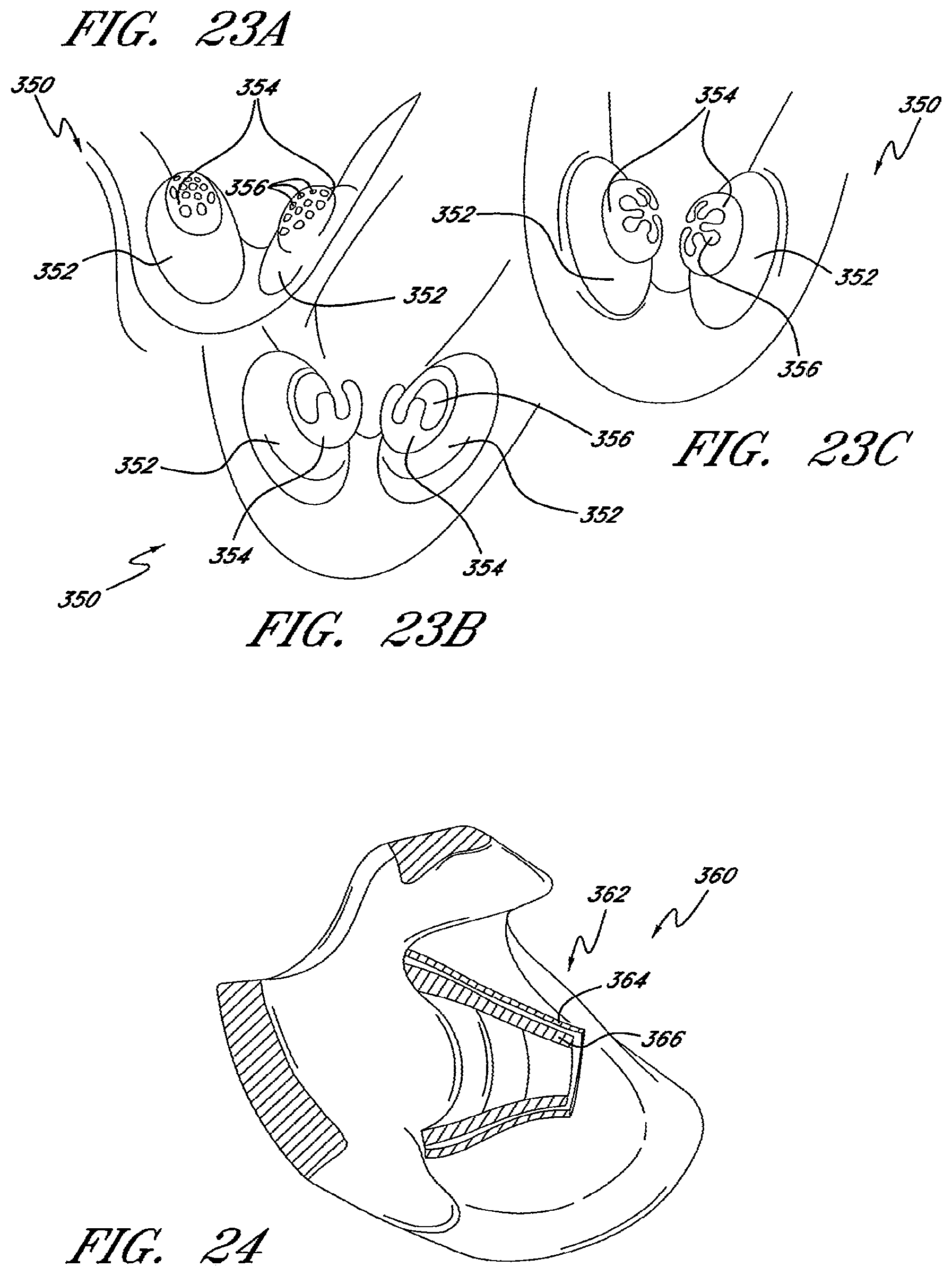 Patent US12576230 Figure 16 – Patient interface and aspects thereof