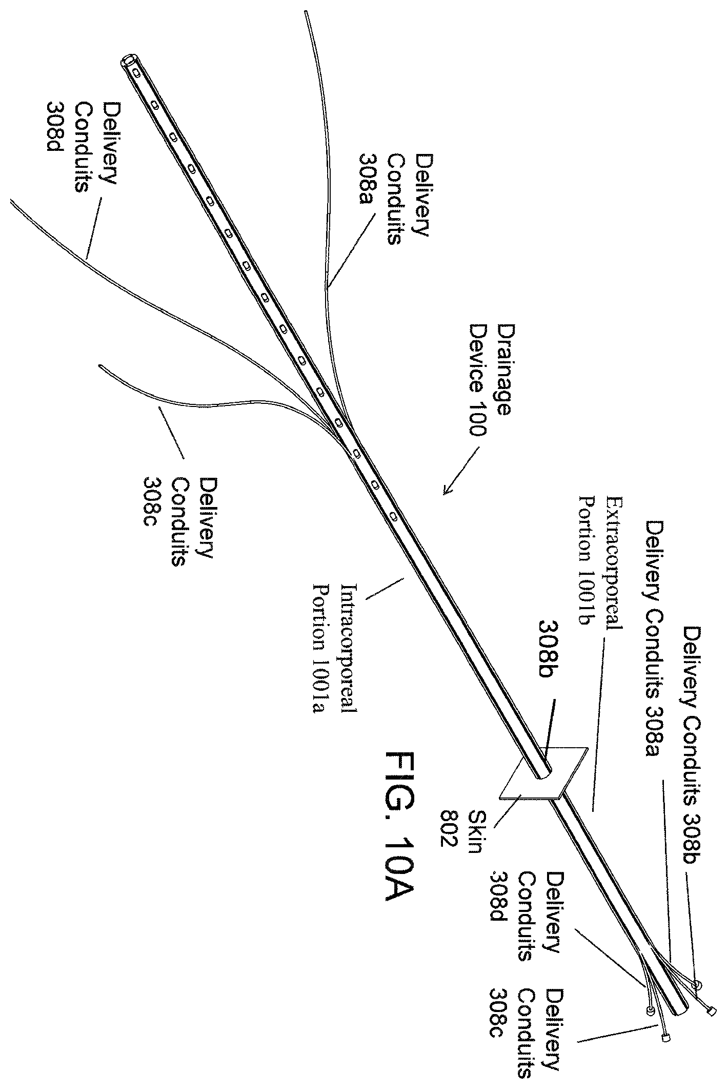Patent US12576238 Figure 6 – Catheter and tube assembly and method of use