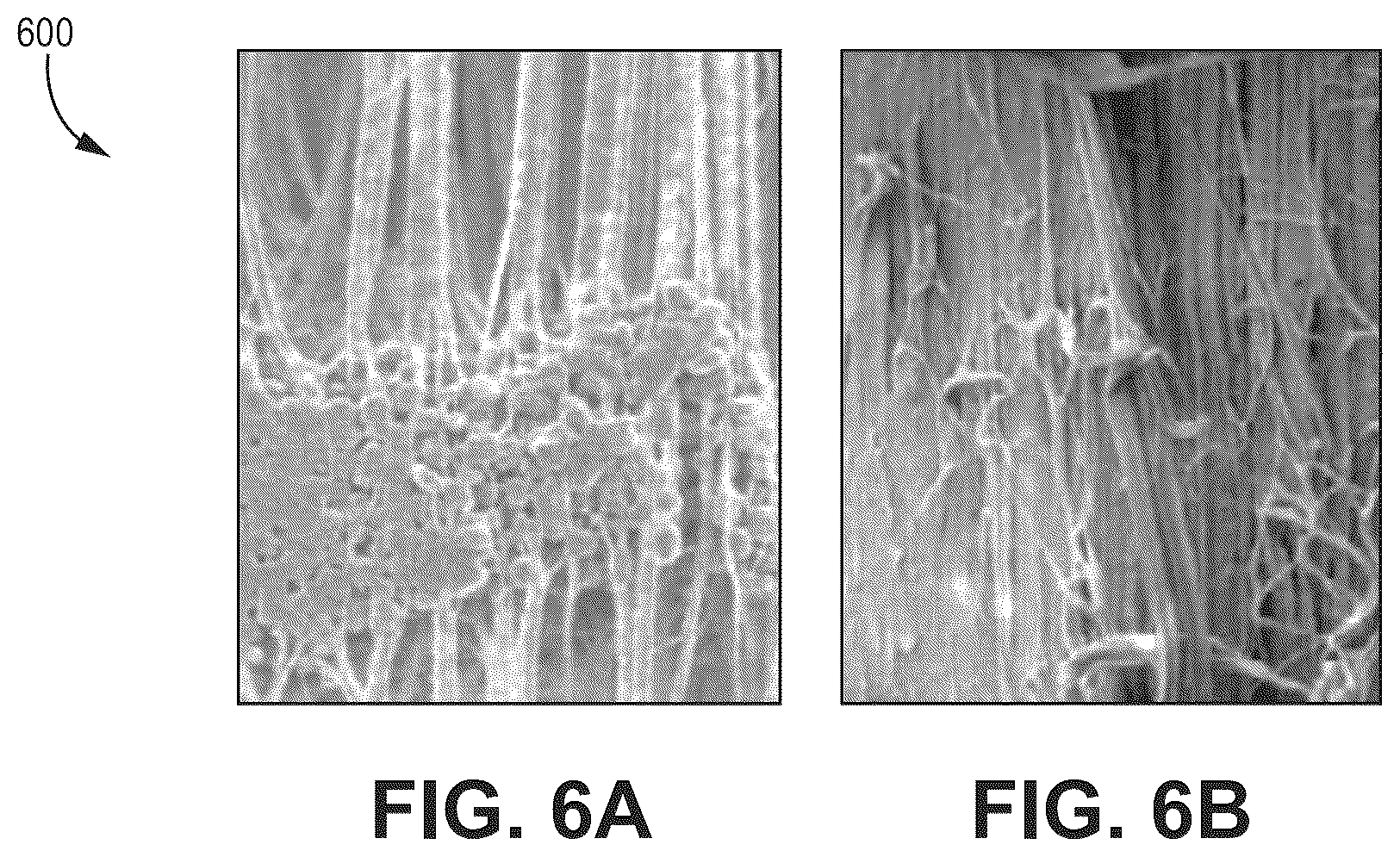 Patent US12576239 Figure 6 – Catheter shaft with flouropolymer inner liner and related methods