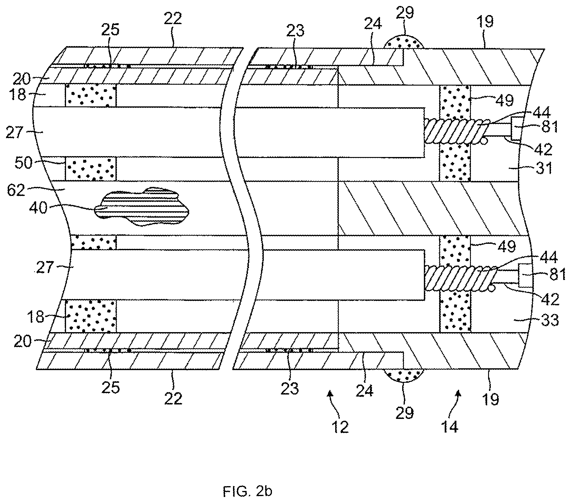 Patent US12576243 Figure 3 – Catheter with multi-functional control handle having linear mechanism