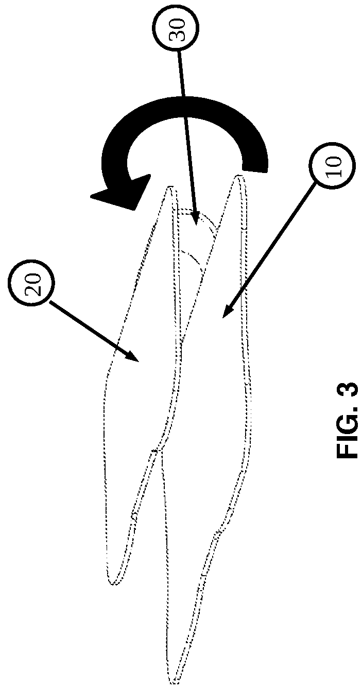 Patent US12576244 Figure 3 – Flexible universal catheter securement device