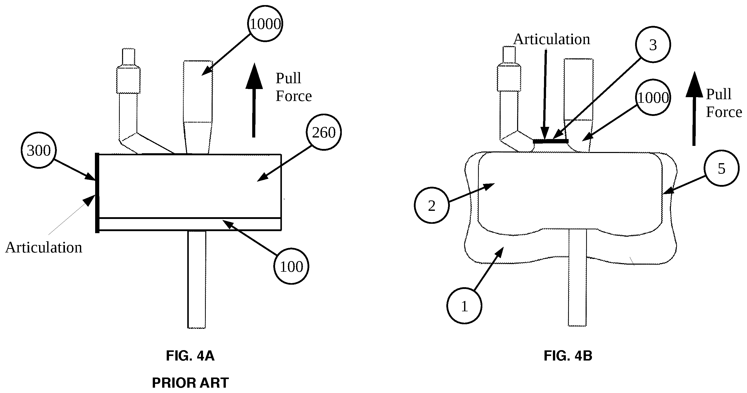 Patent US12576244 Figure 4 – Flexible universal catheter securement device