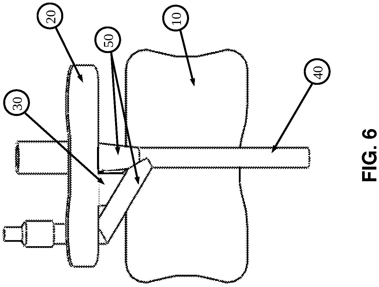Patent US12576244 Figure 6 – Flexible universal catheter securement device