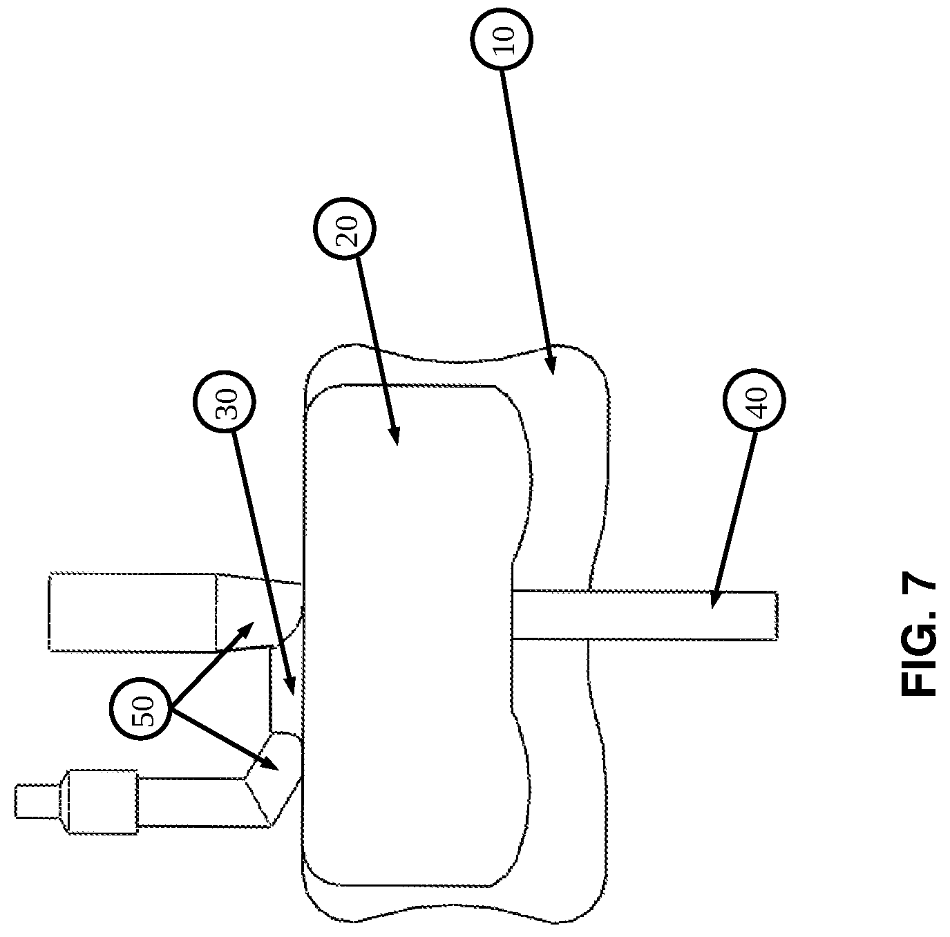 Patent US12576244 Figure 7 – Flexible universal catheter securement device
