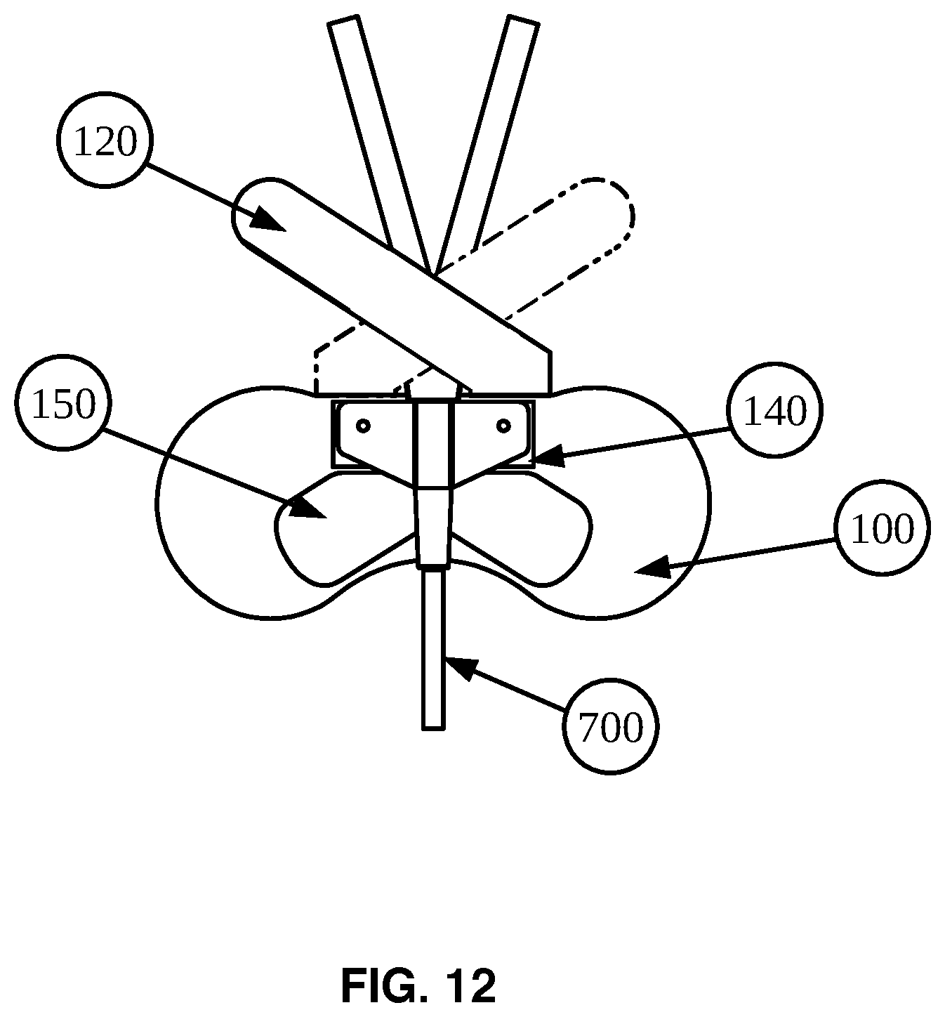 Patent US12576244 Figure 12 – Flexible universal catheter securement device