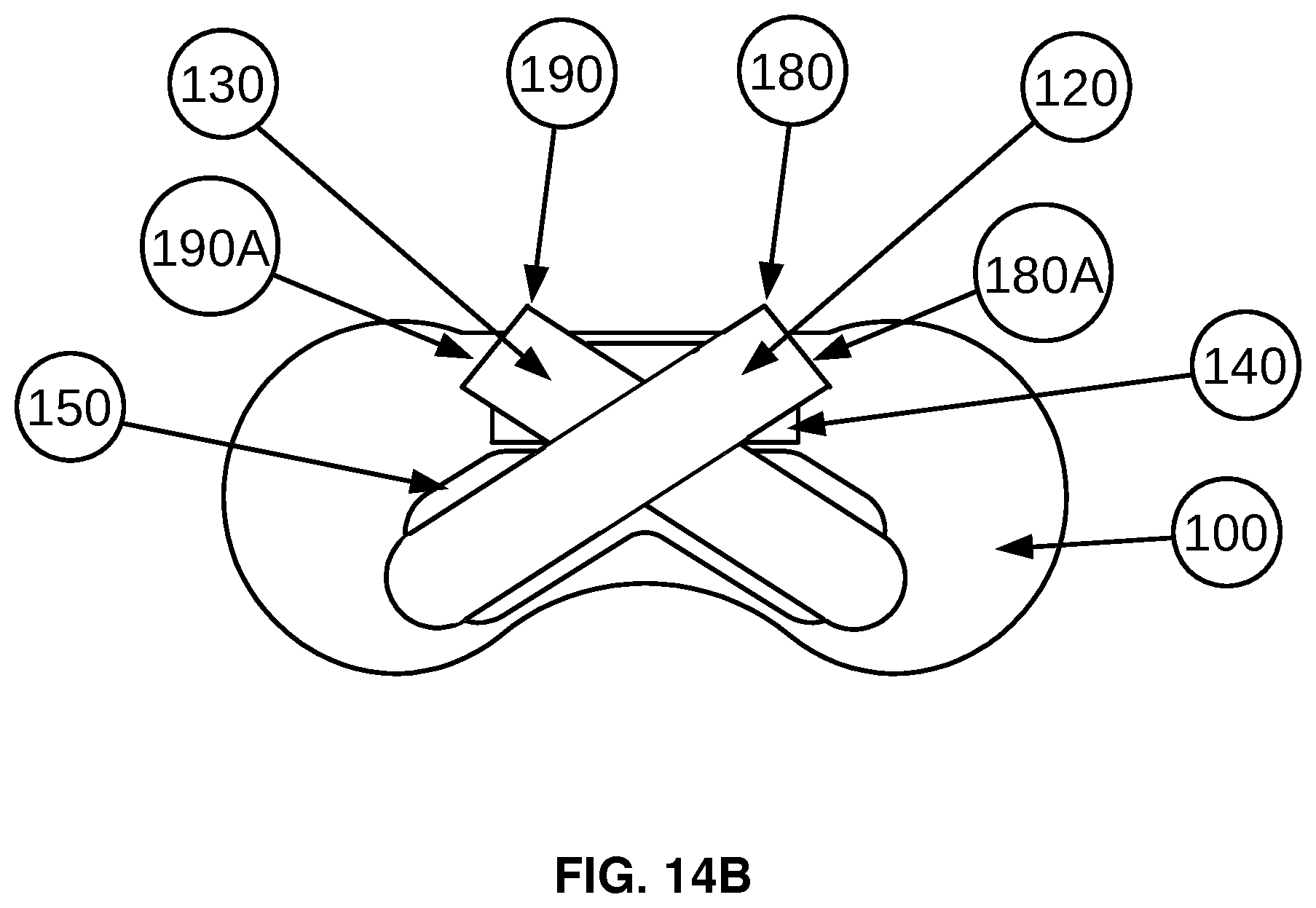 Patent US12576244 Figure 15 – Flexible universal catheter securement device