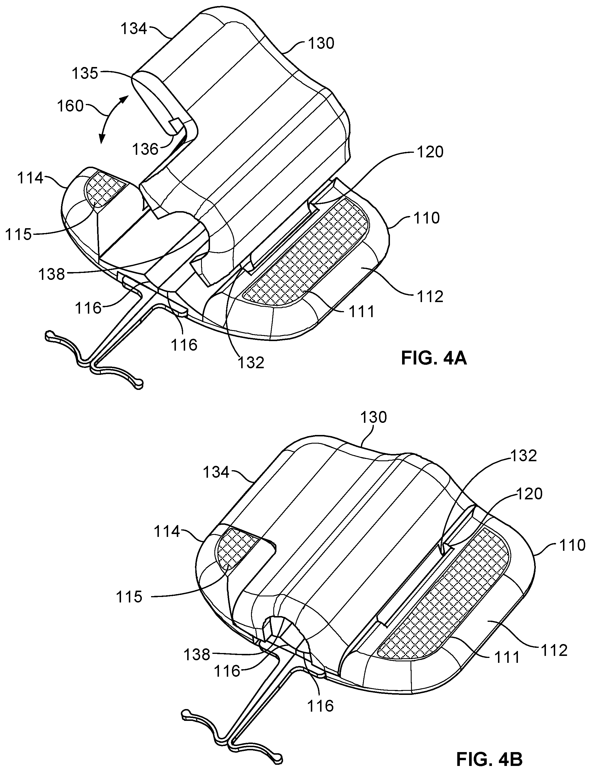 Patent US12576245 Figure 4 – Systems and methods for anchoring medical devices