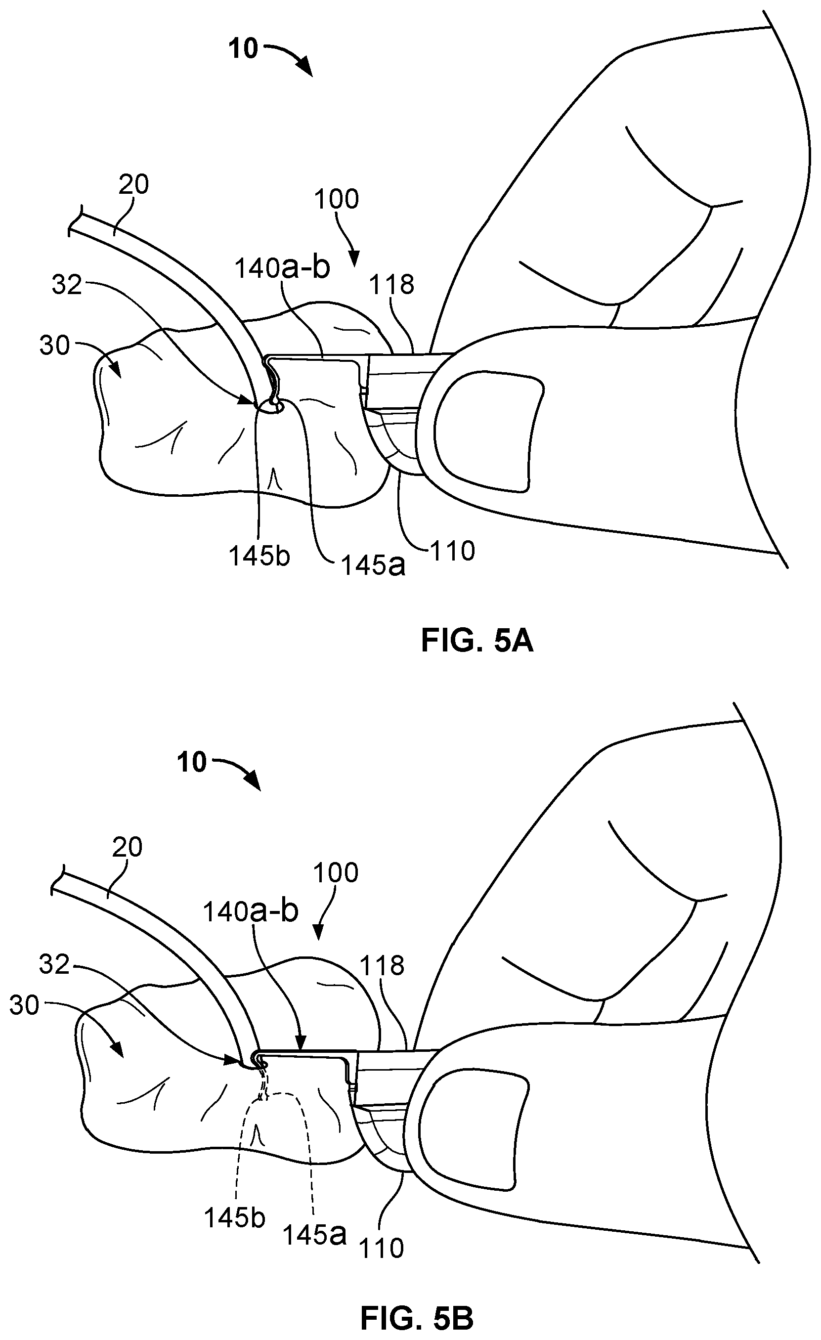Patent US12576245 Figure 5 – Systems and methods for anchoring medical devices
