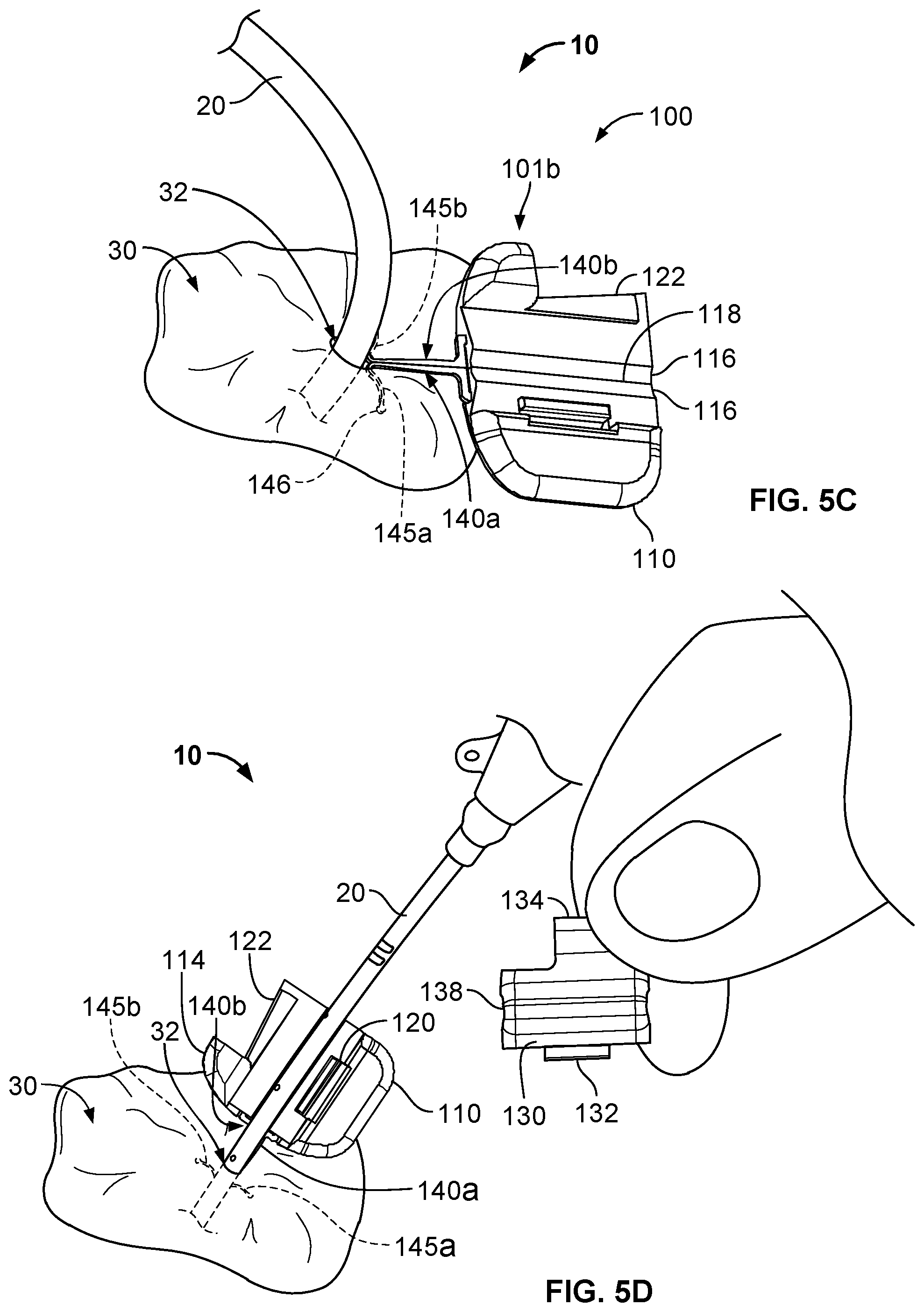Patent US12576245 Figure 6 – Systems and methods for anchoring medical devices