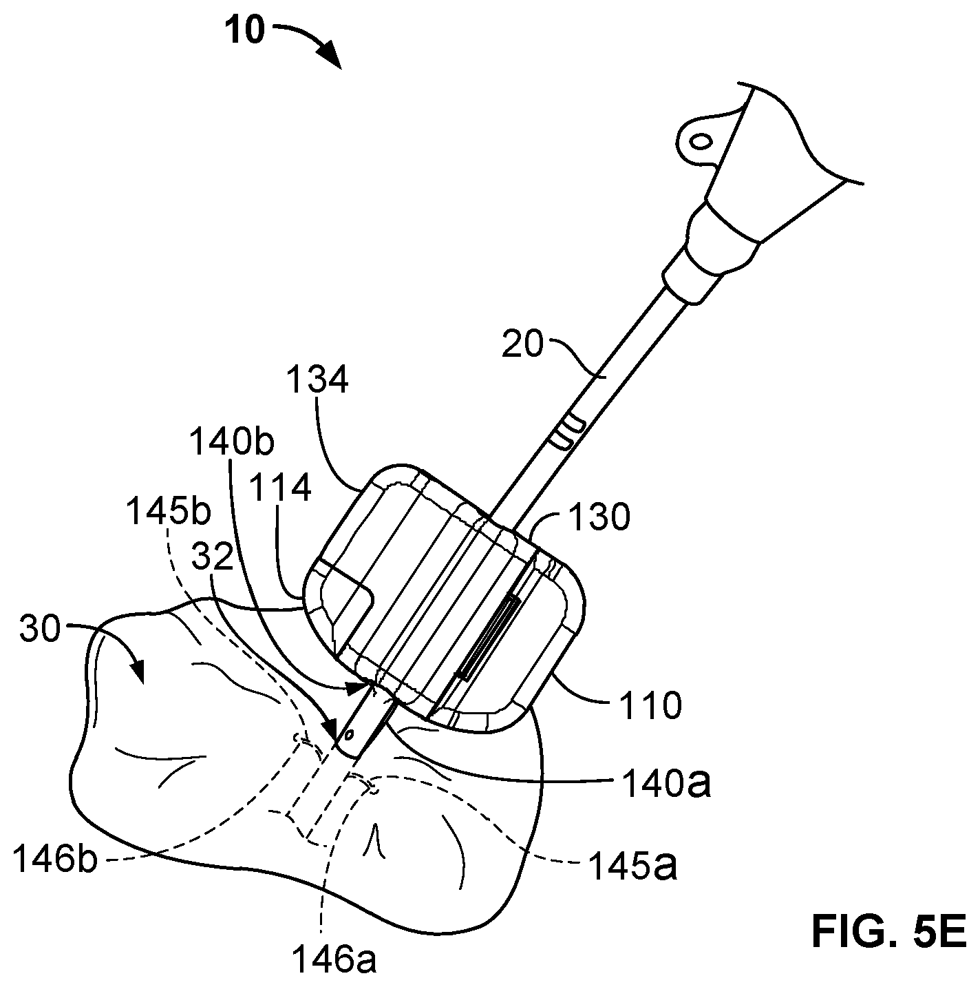 Patent US12576245 Figure 7 – Systems and methods for anchoring medical devices