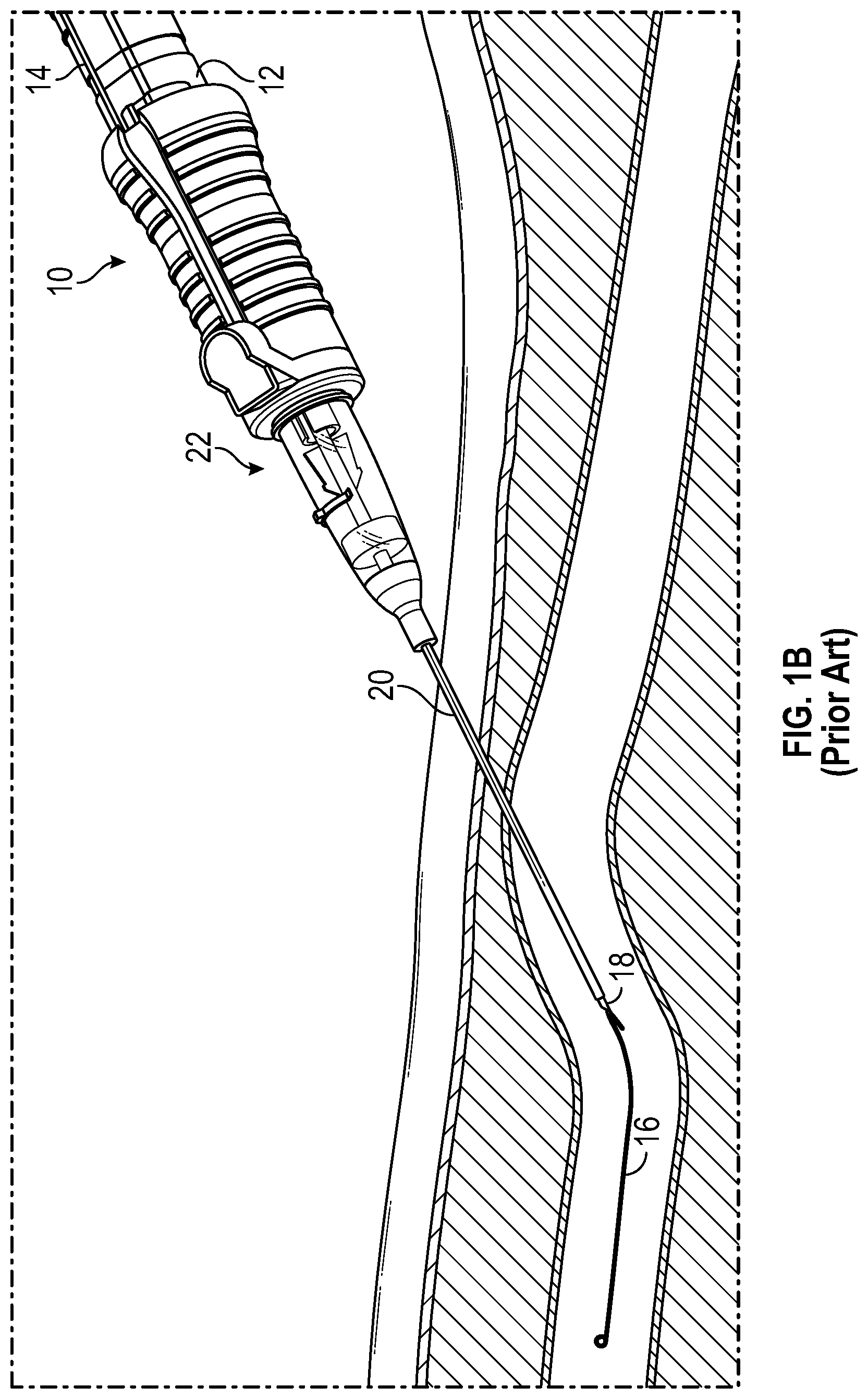 Patent US12576246 Figure 2 – Catheter system having a guidewire slider