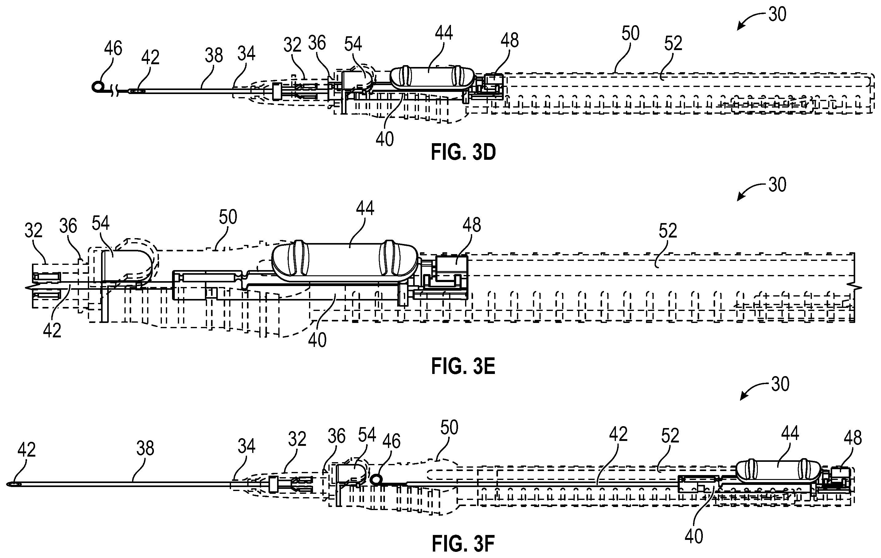 Patent US12576246 Figure 8 – Catheter system having a guidewire slider