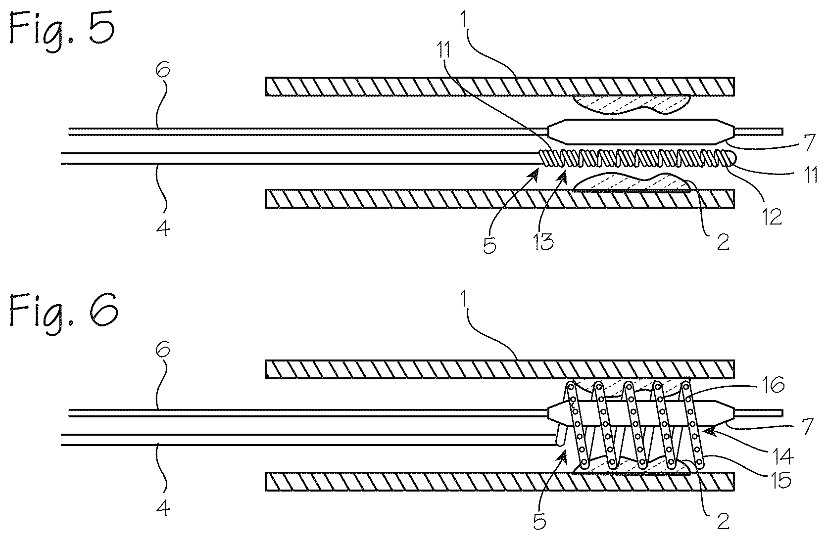 Patent US12576249 Figure 2 – Infusion catheter and balloon catheter system and method