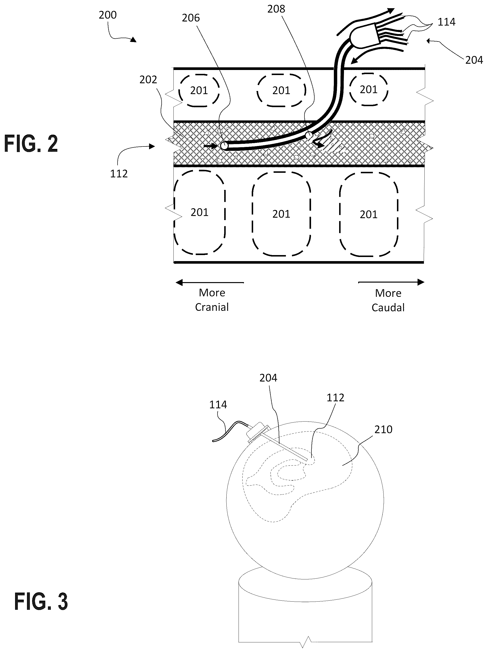 Patent US12576251 Figure 2 – Systems and methods for the conditioning of cerebrospinal fluid